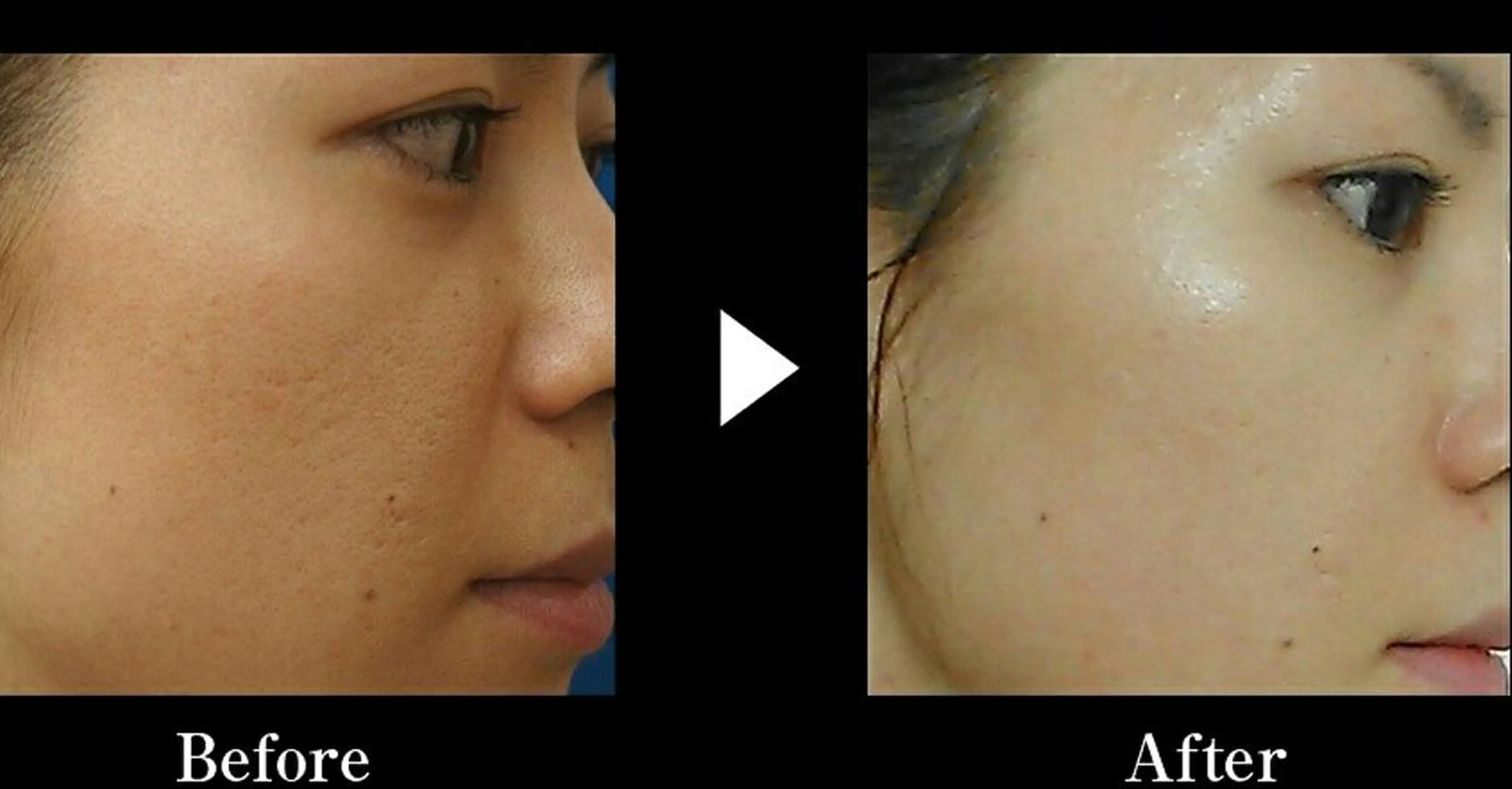 ネイル マツエク・マツパ ヘアアレンジ 次世代まつげパーマは 『リベル名古屋』のマツエク・マツパデザイン