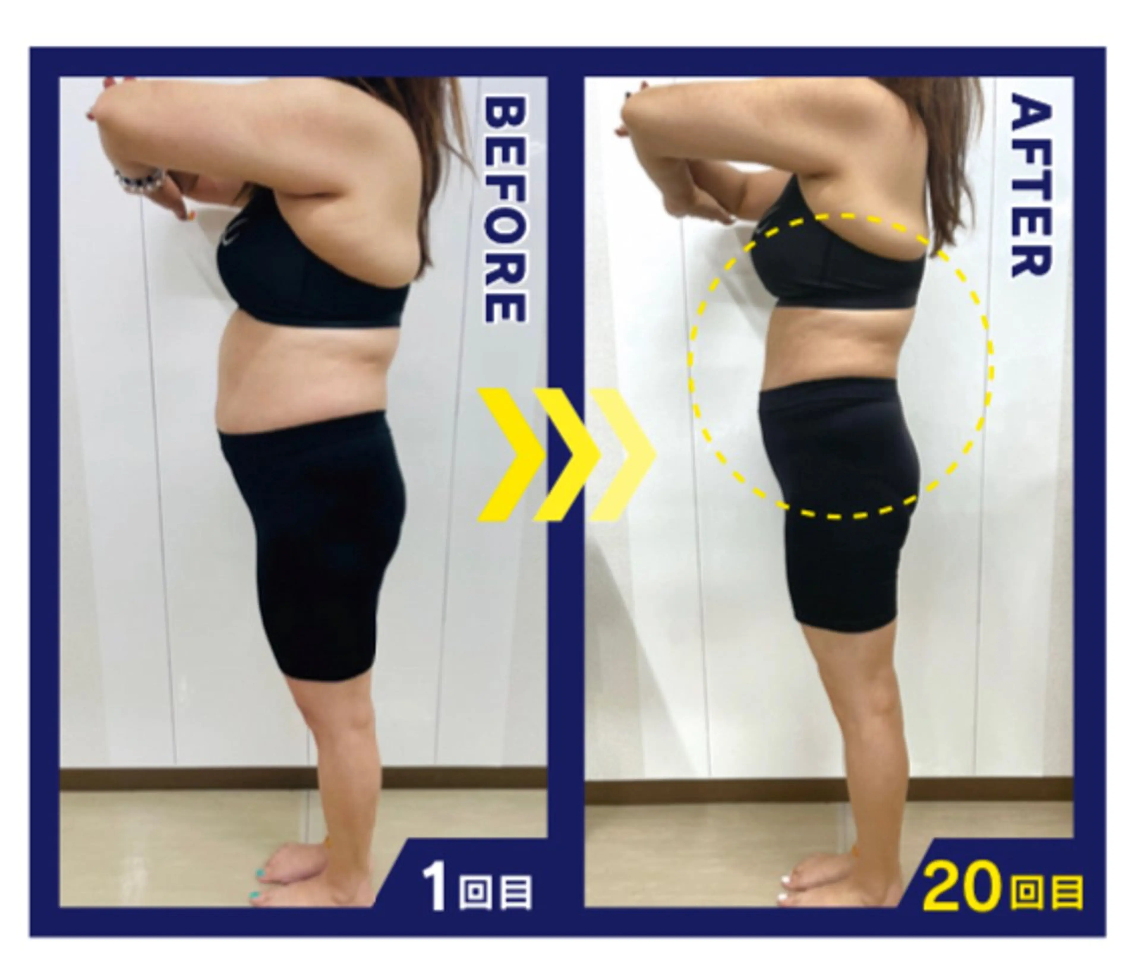 《当サロンおススメ》セルフボディーメイク痩身マンスリープラン(会員制)１回30分　最大1ヶ月15回施術可能　人数に限り☆の写真