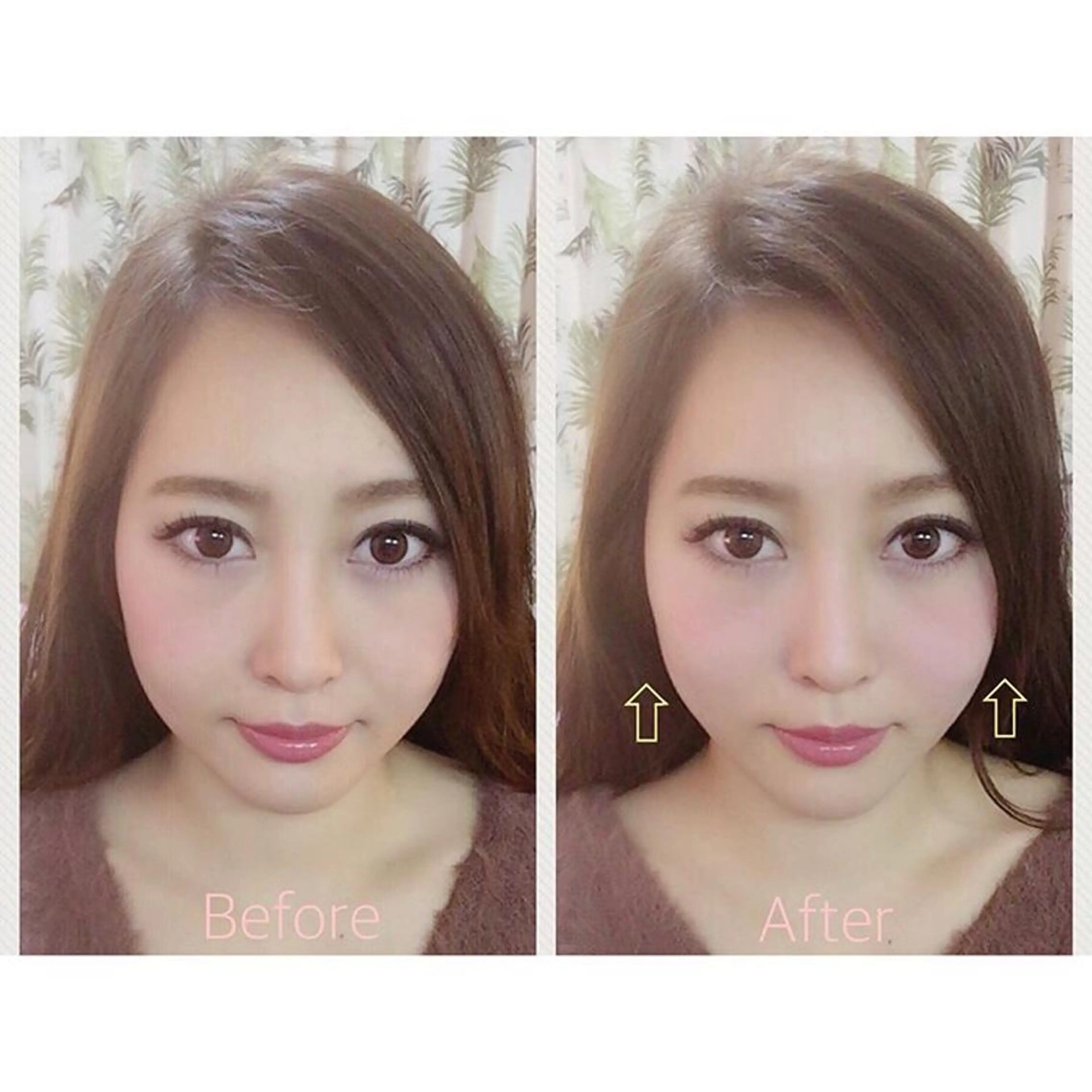 鍼灸salon mのエステ・リラクイメージ