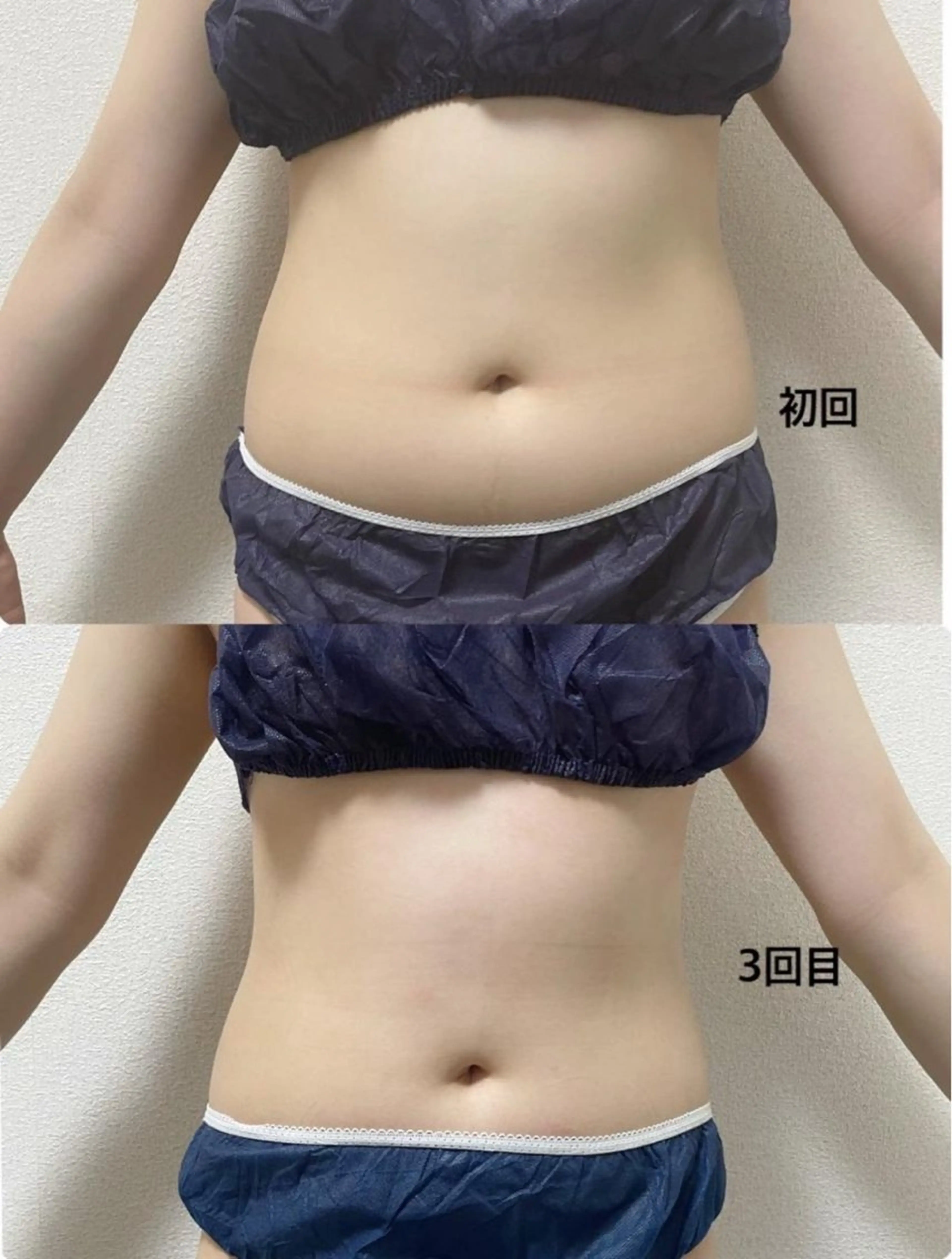 マツエク・マツパ エステ リラク 愛維美水光美肌専門店所属・愛維美水光美肌専門店 メンズレディースokのエステ・リラクイメージ