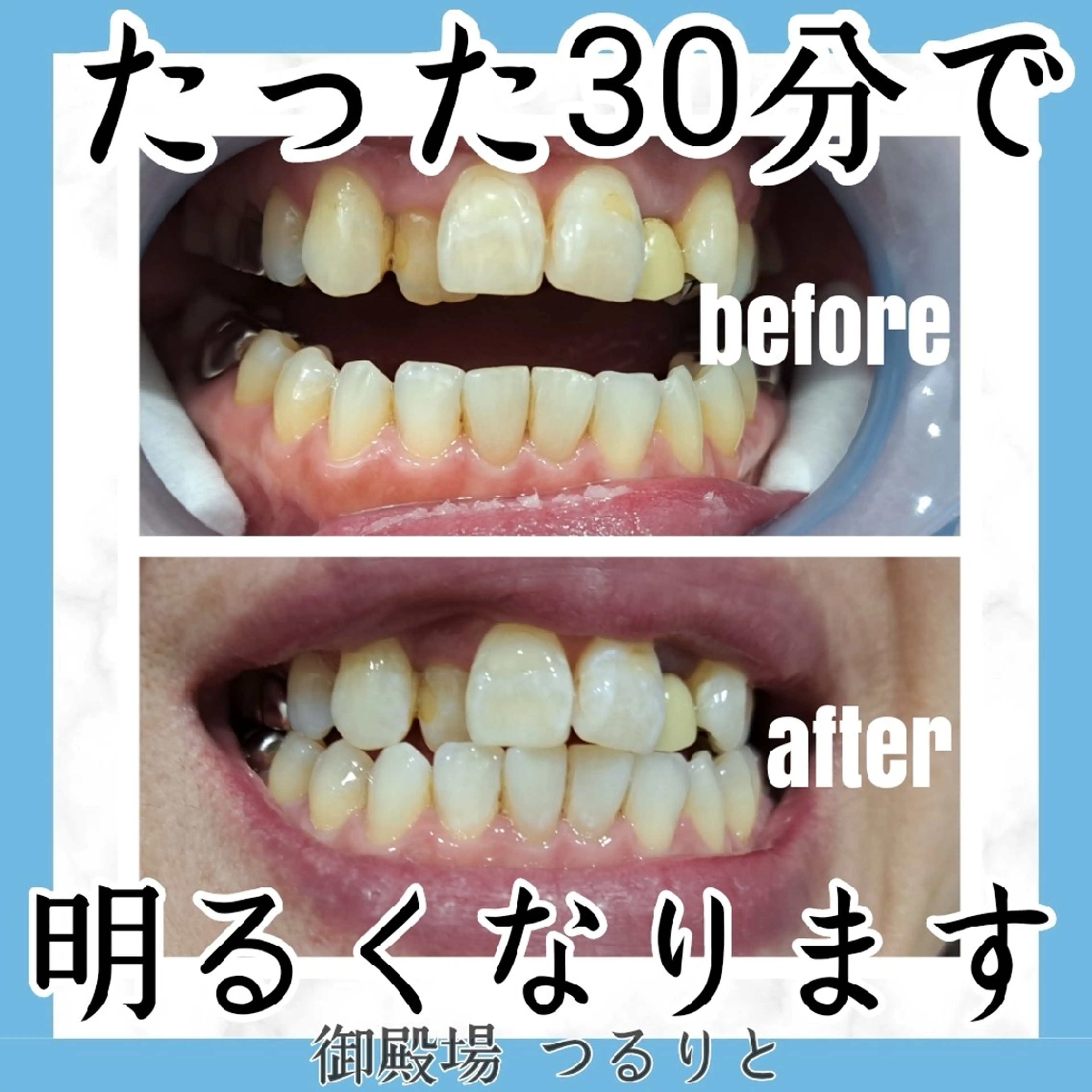 美肌脱毛サロン つるりと御殿場店所属・美肌脱毛サロン つるりとのその他イメージ