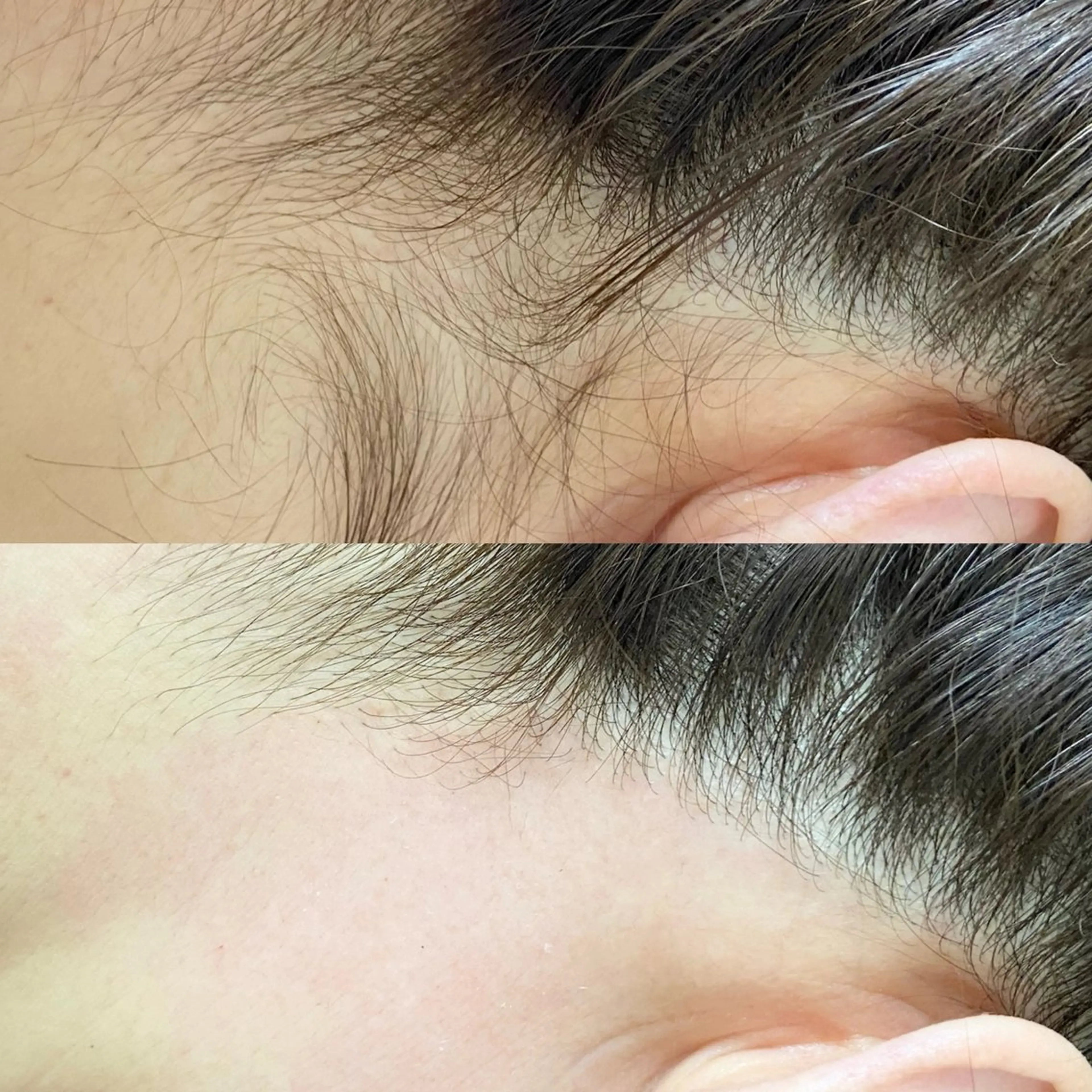 脱毛 &me ayakaのエステ・リラクイメージ