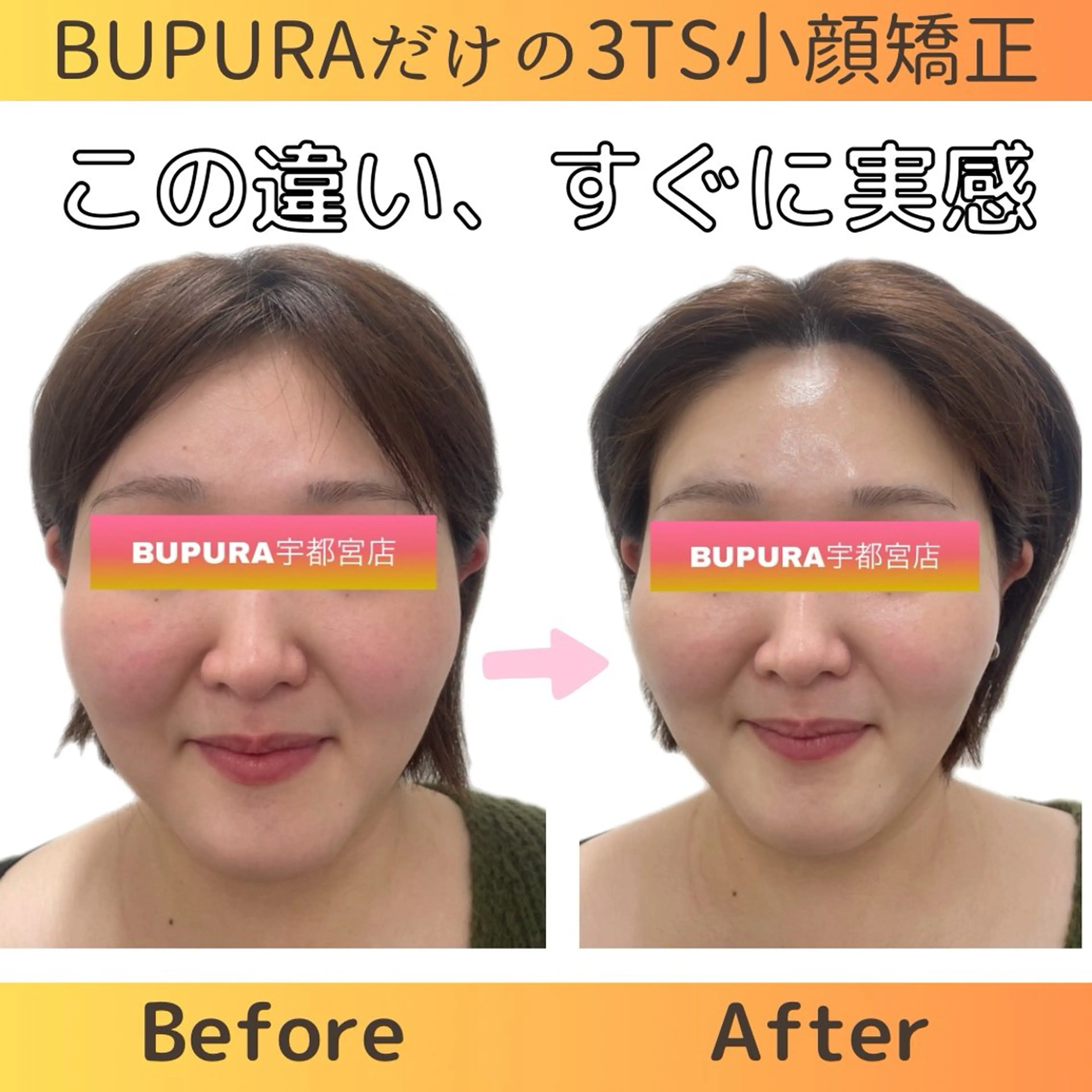 【BUPURA式頭蓋骨小顔骨格フェイシャル】の写真