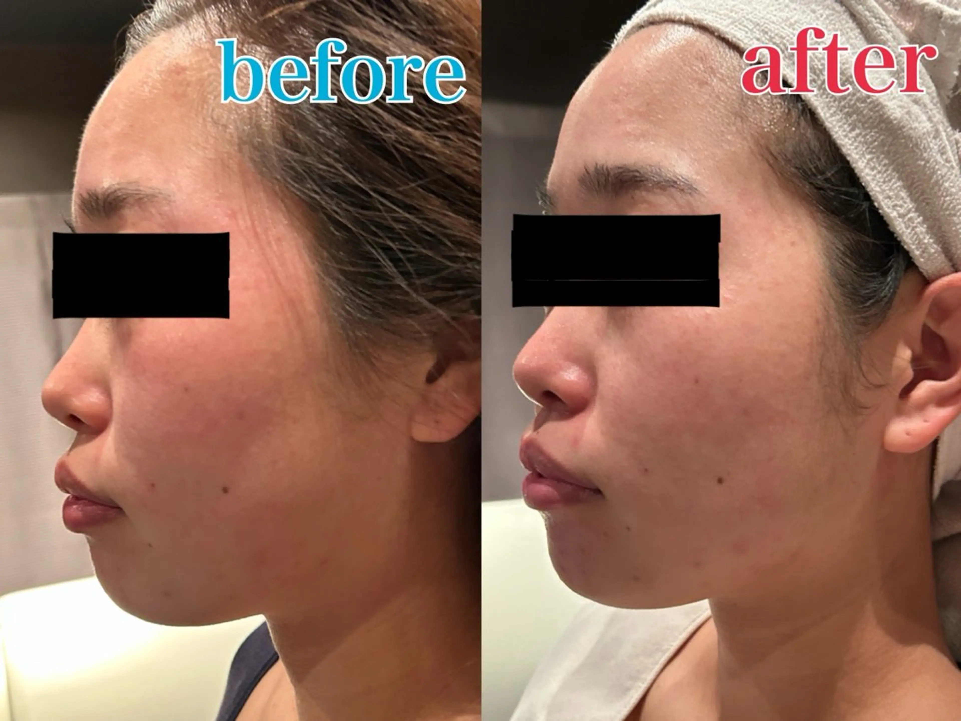 エステ リラク デ・アイム鴻巣所属・素肌美づくりサロン 《鴻巣・熊谷》のエステ・リラクイメージ