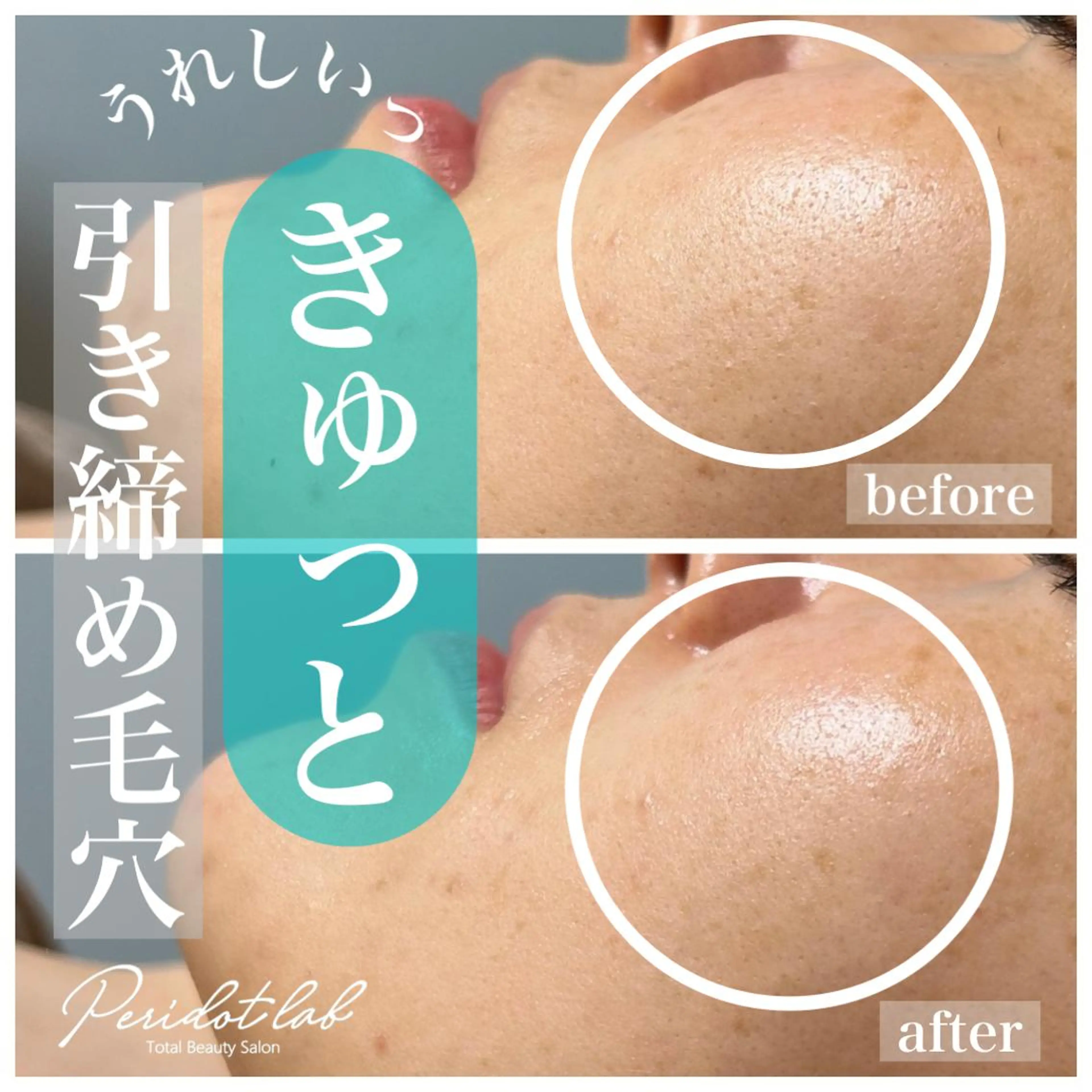 ペリドットラボ naoのエステ・リラクイメージ