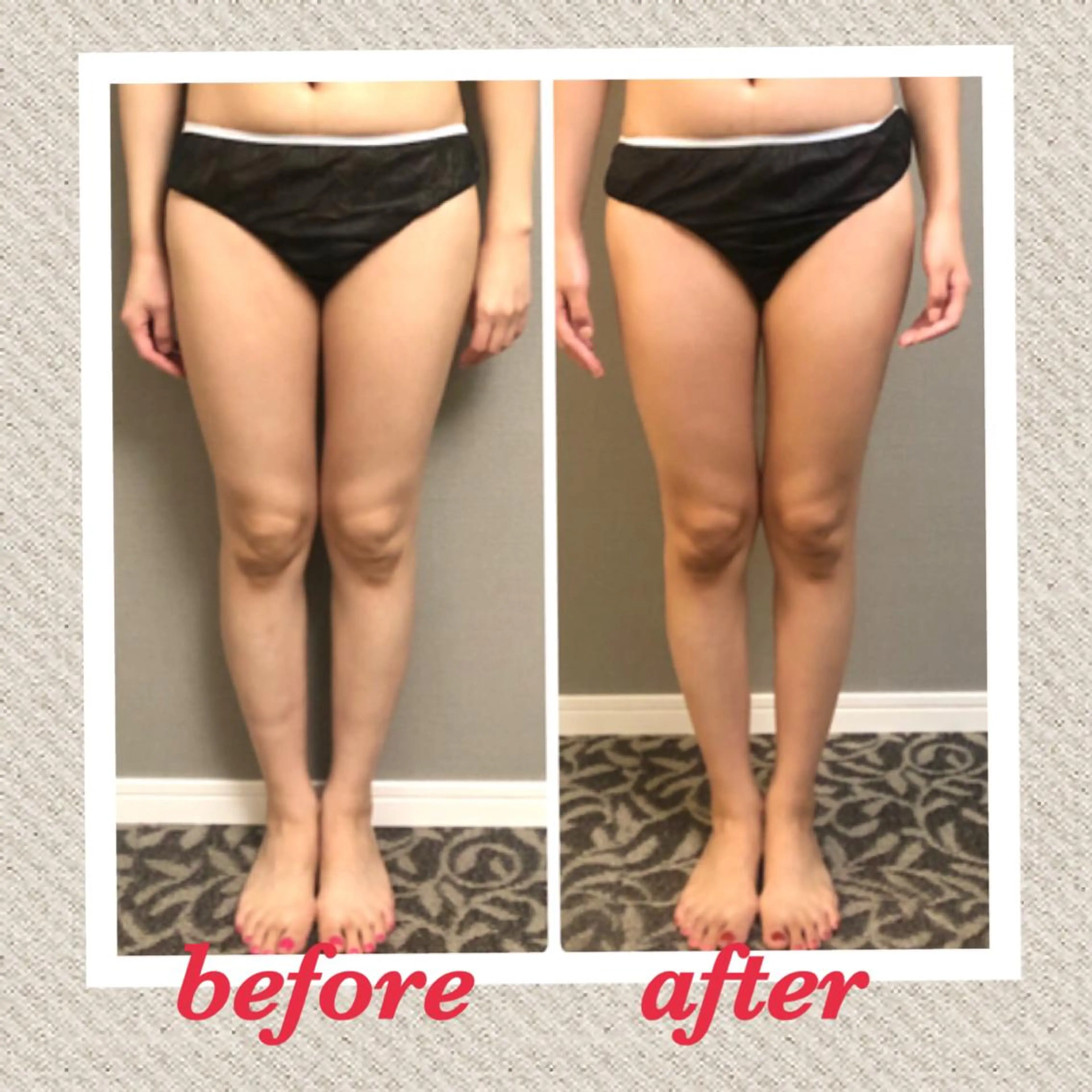 エステ リラク 美ola ビオラのエステ・リラクイメージ