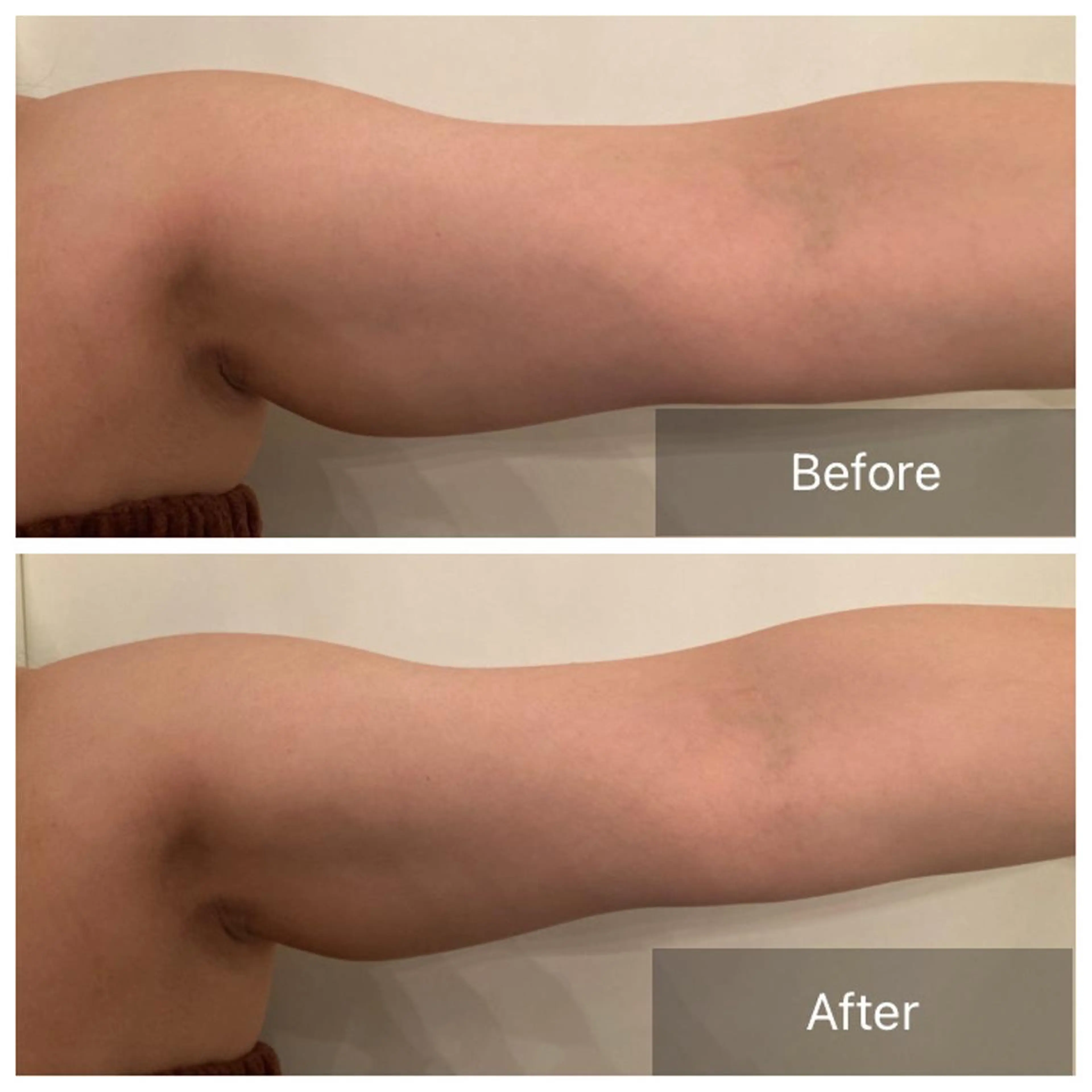 Lumiere despoir所属・Lumiere despoirのエステ・リラクイメージ