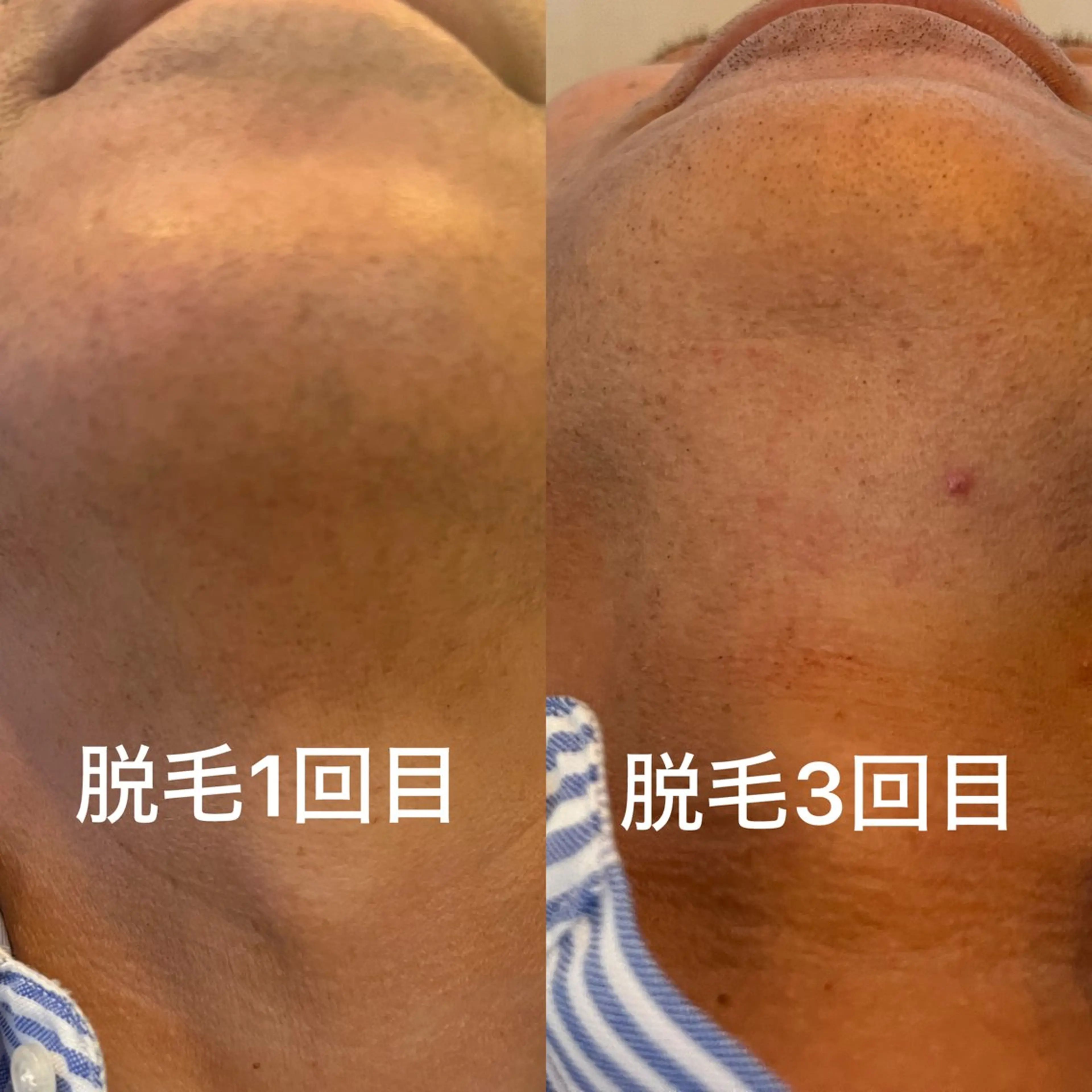 メンズ 脱毛 eto ileのエステ・リラクイメージ