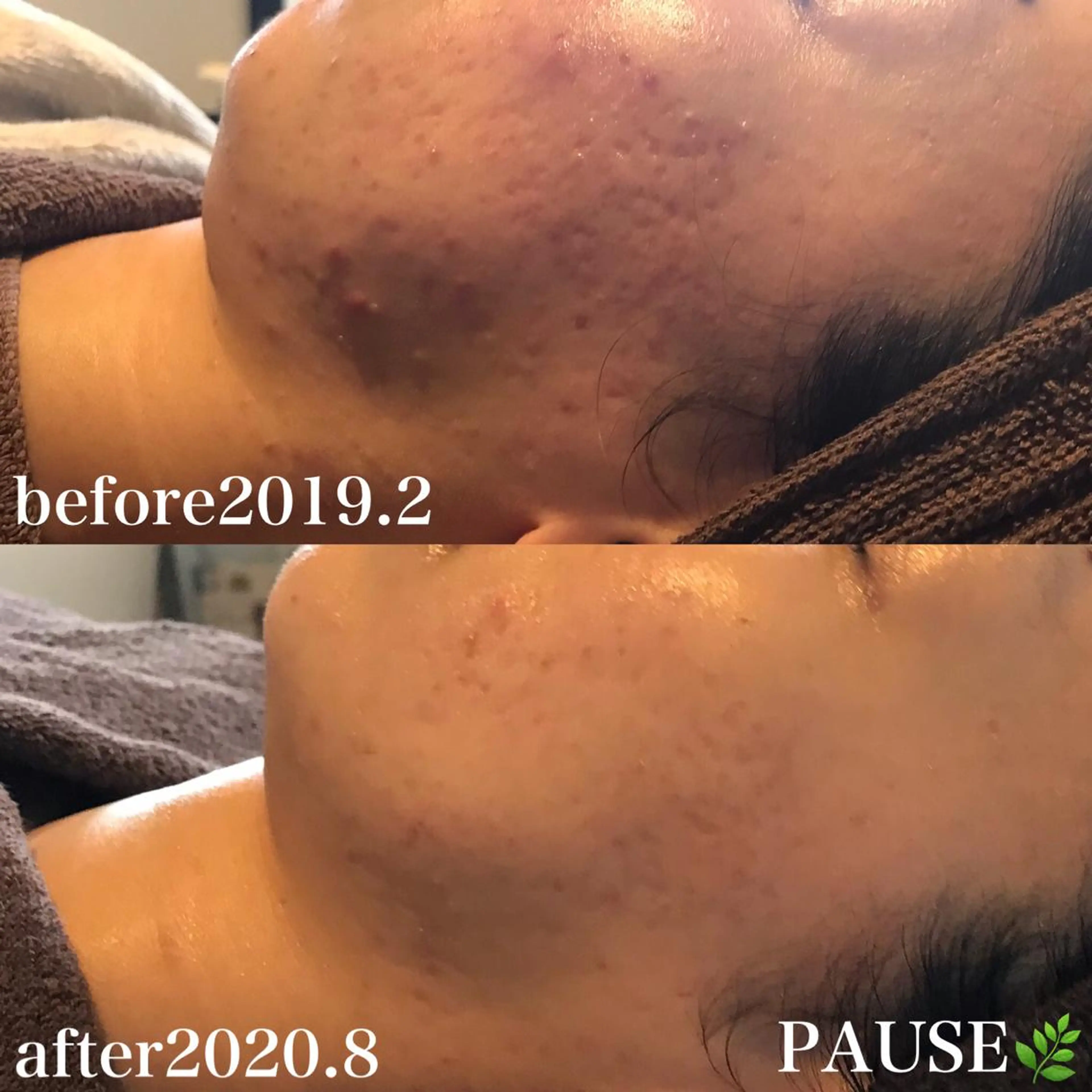 エステ 浜野 恵美のエステ・リラクイメージ