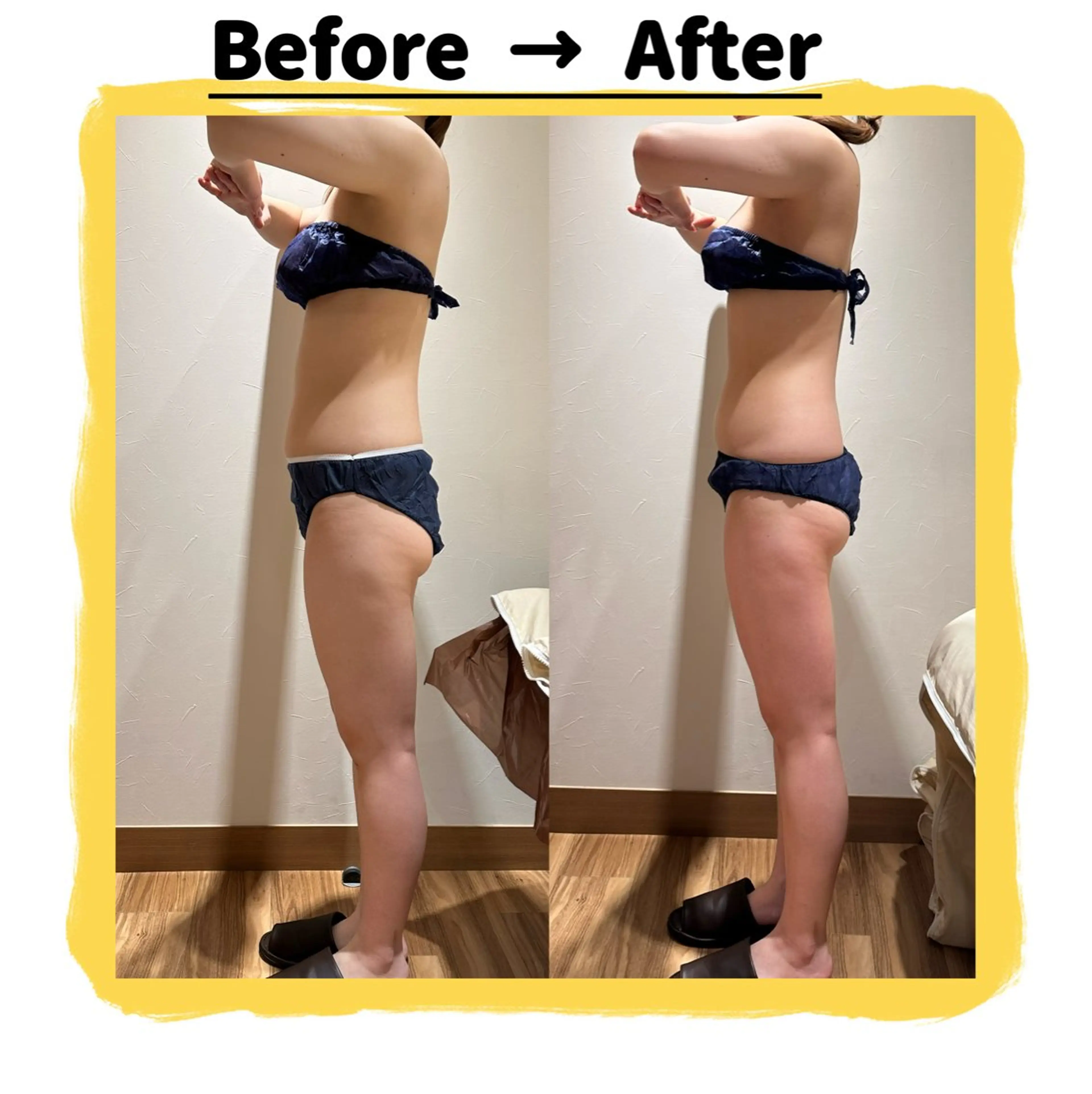 【根本改善❤️‍🔥効果No.1⚜️】イベント前や日頃のご褒美に、徹底的にサイズダウン‼️最強全身ボディコース🫶🏻の写真
