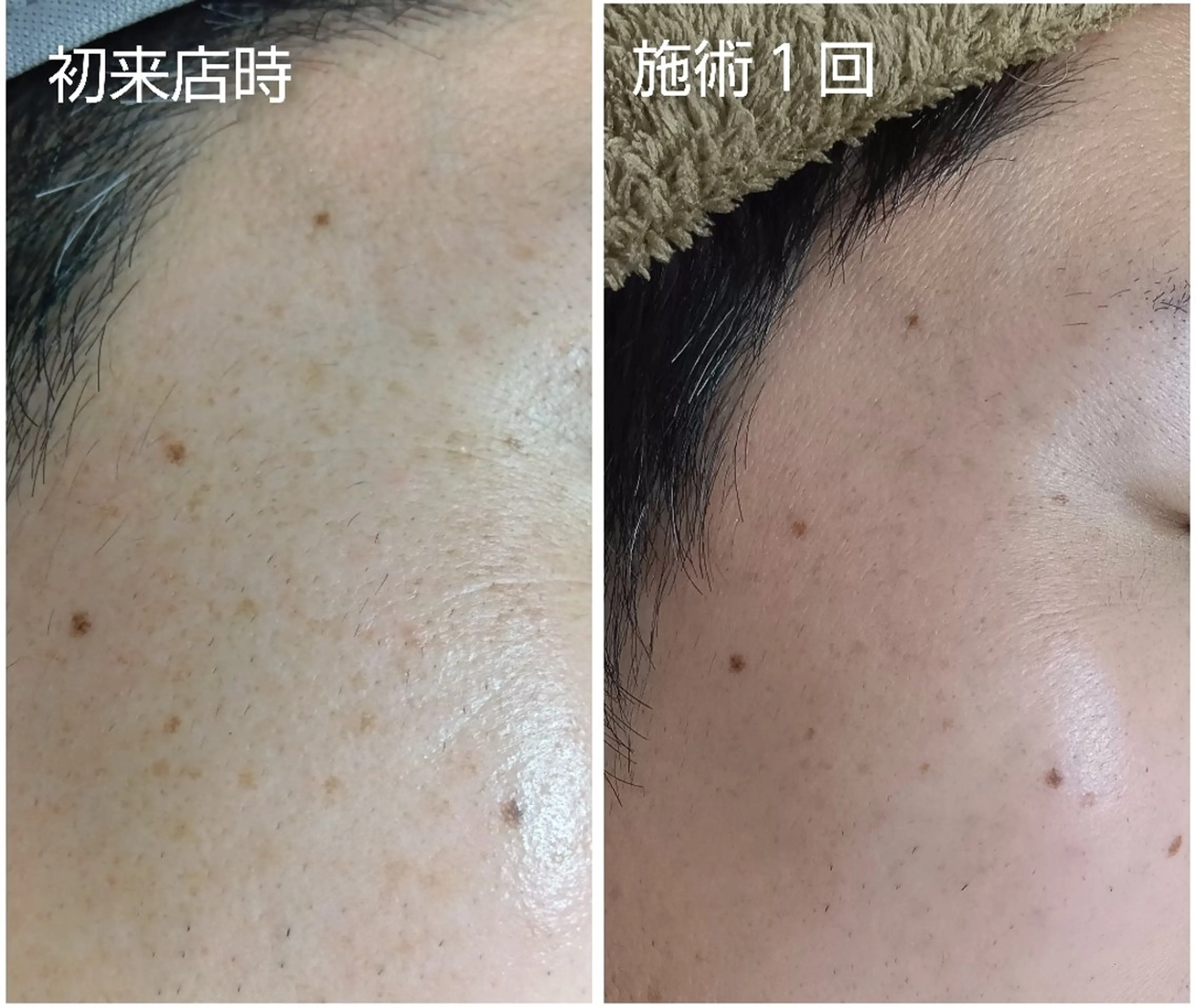 シミケア専門店 HAQUAのその他イメージ