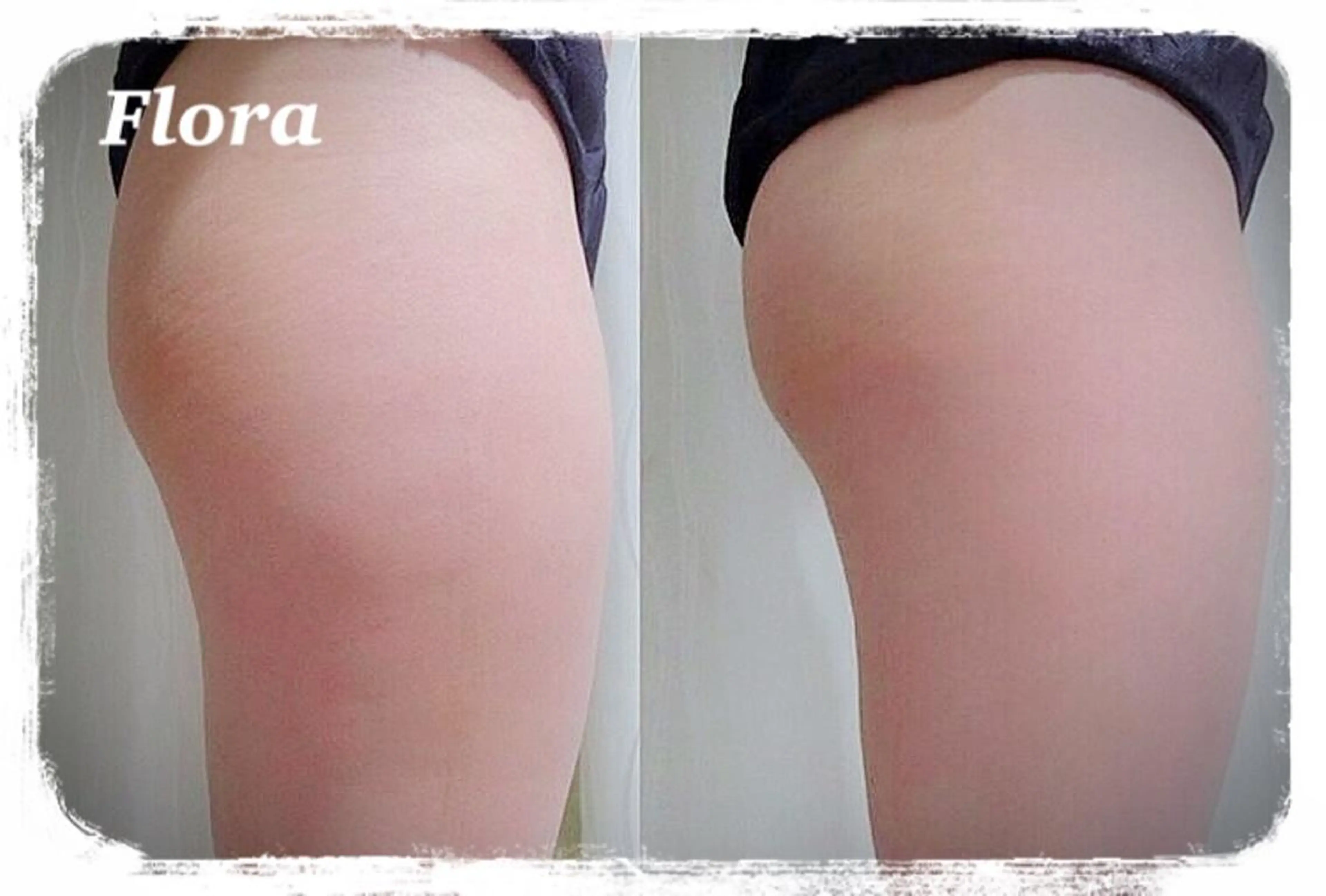 温活痩身エステ Floraのエステ・リラクイメージ