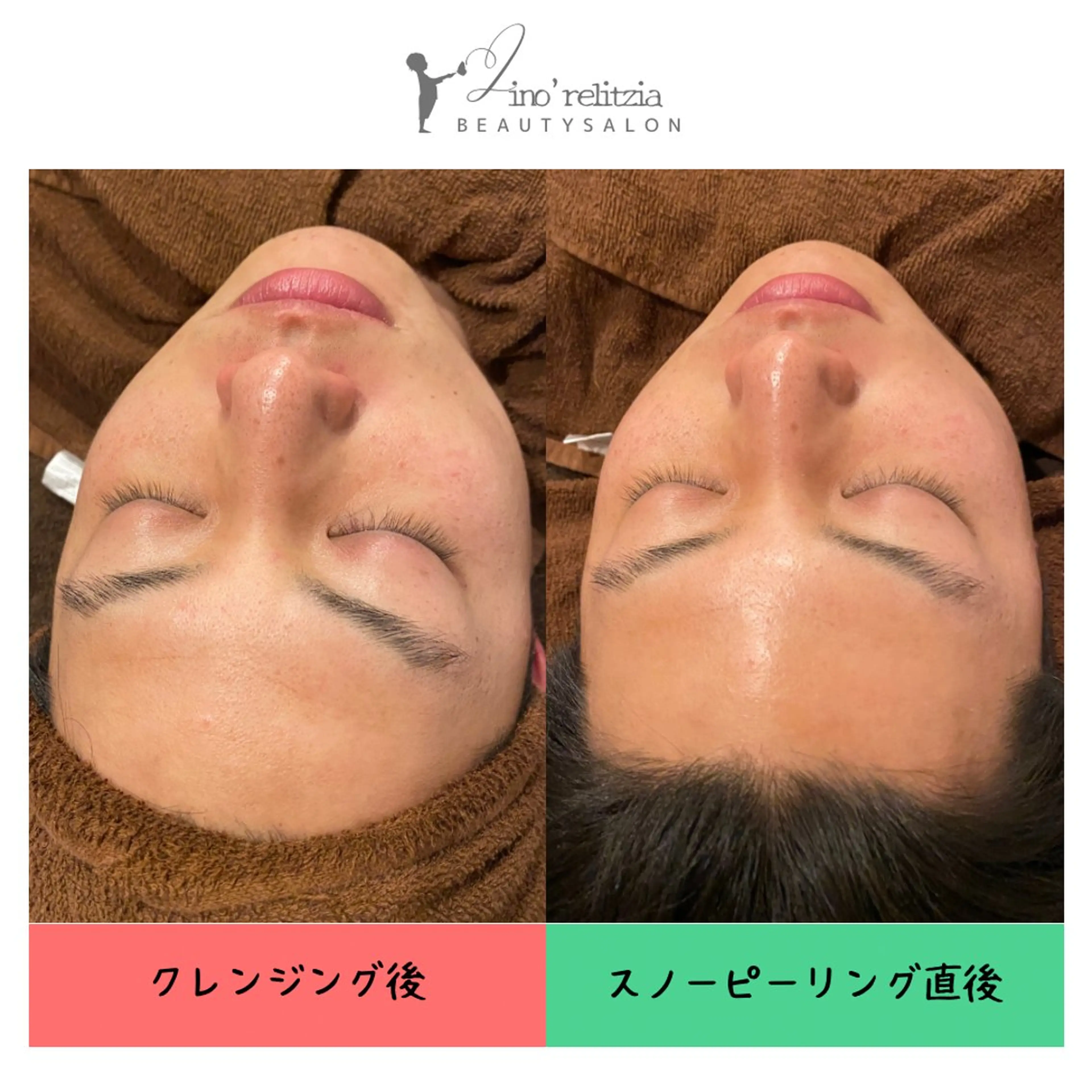 リノレリチア 新町店のエステ・リラクイメージ