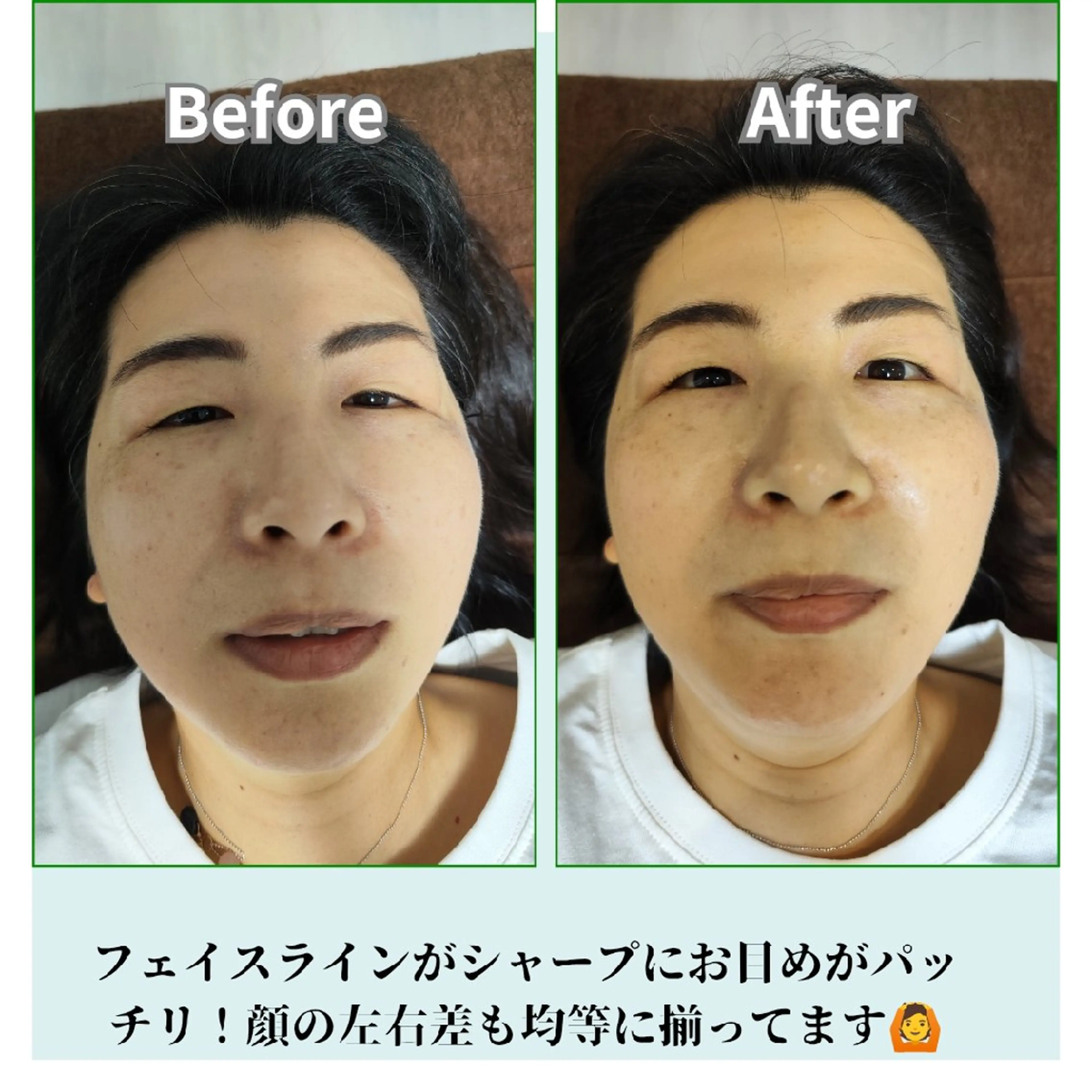 美容鍼サロン　それいゆ所属・鍼灸サロンそれいゆ 石河佳恵のエステ・リラクイメージ