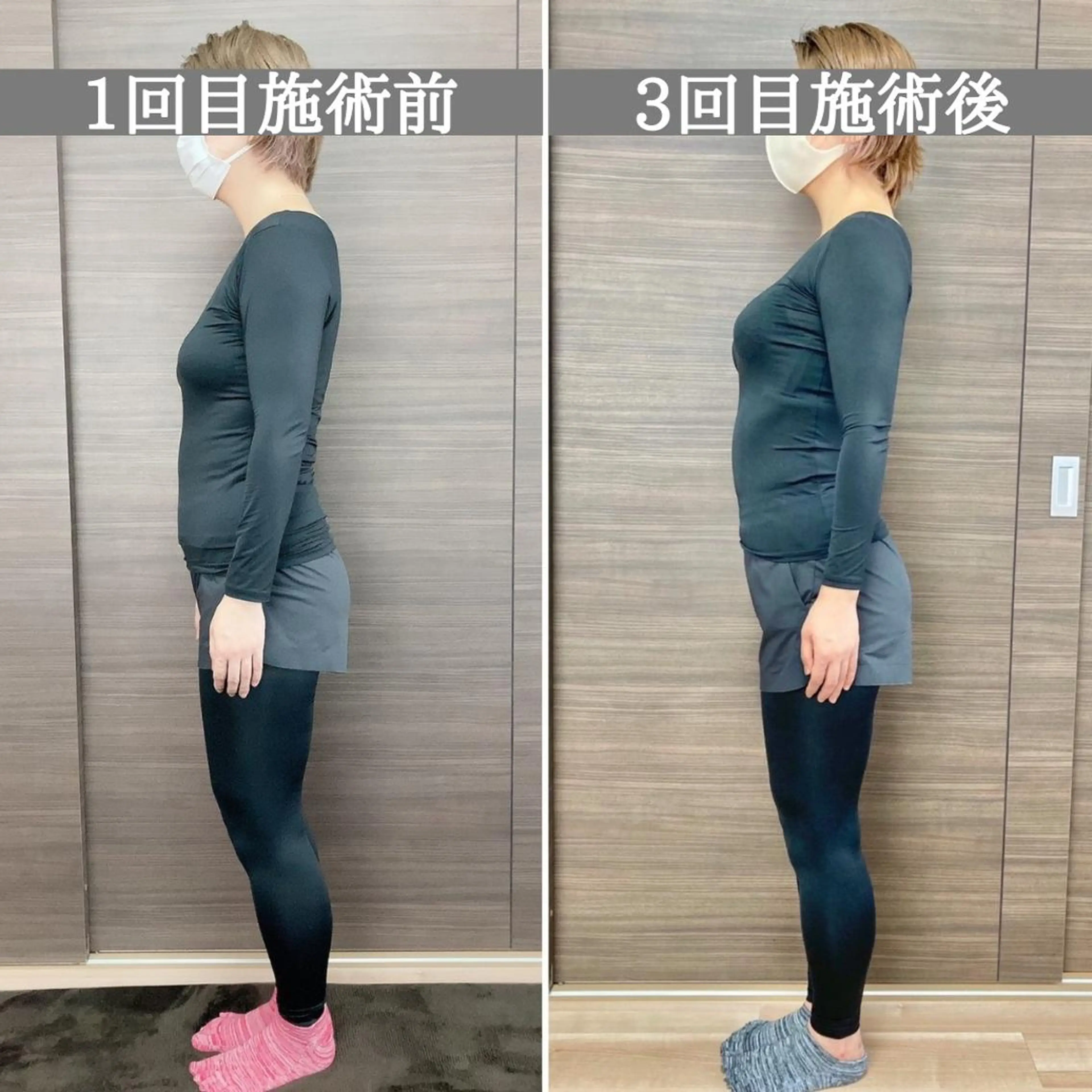 【マタニティ・産後】👶マタニティケアor産後骨盤矯正 40分 ¥12,100→¥5,500の写真