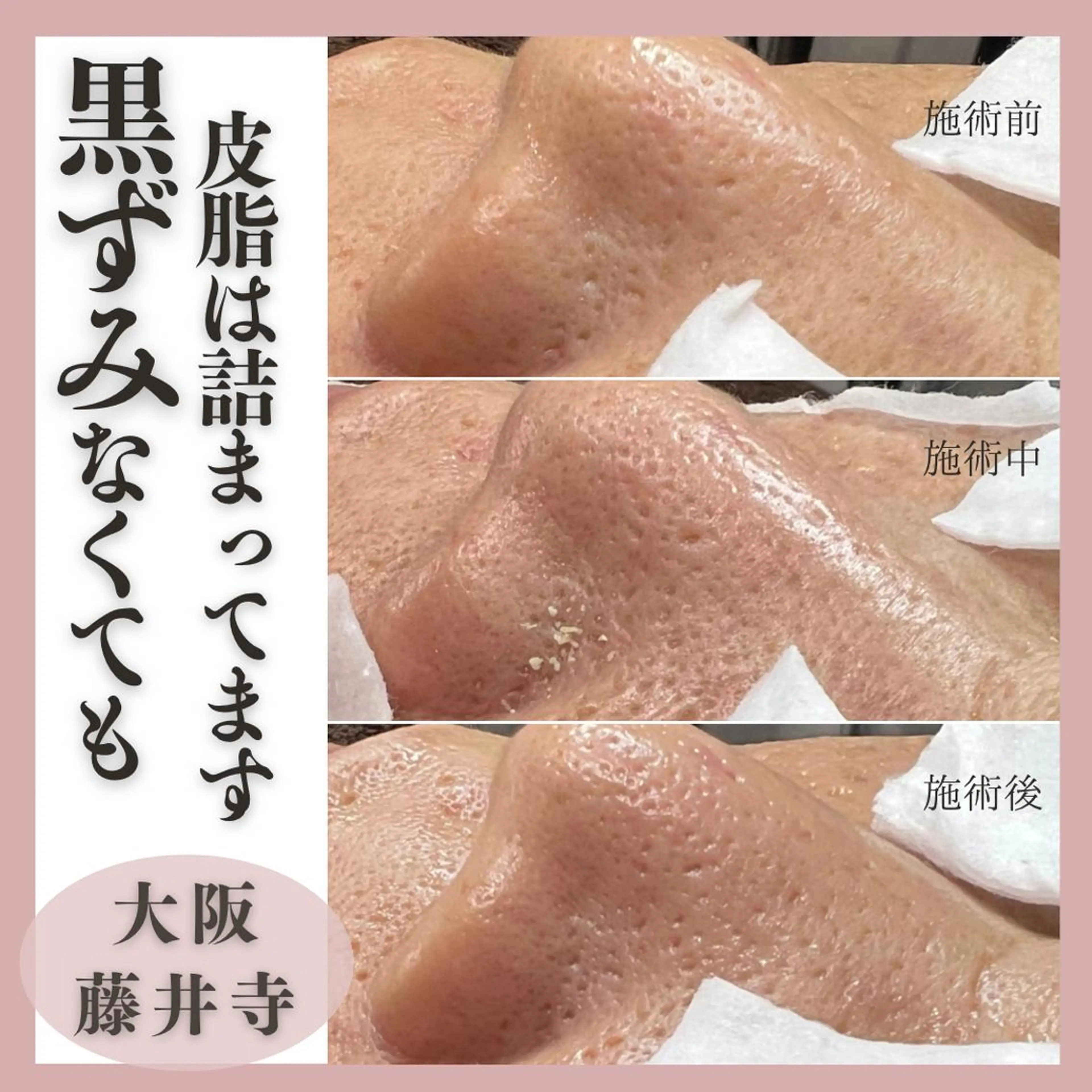 エステ Muqu.所属・Muqu. 毛穴サロンのエステ・リラクイメージ