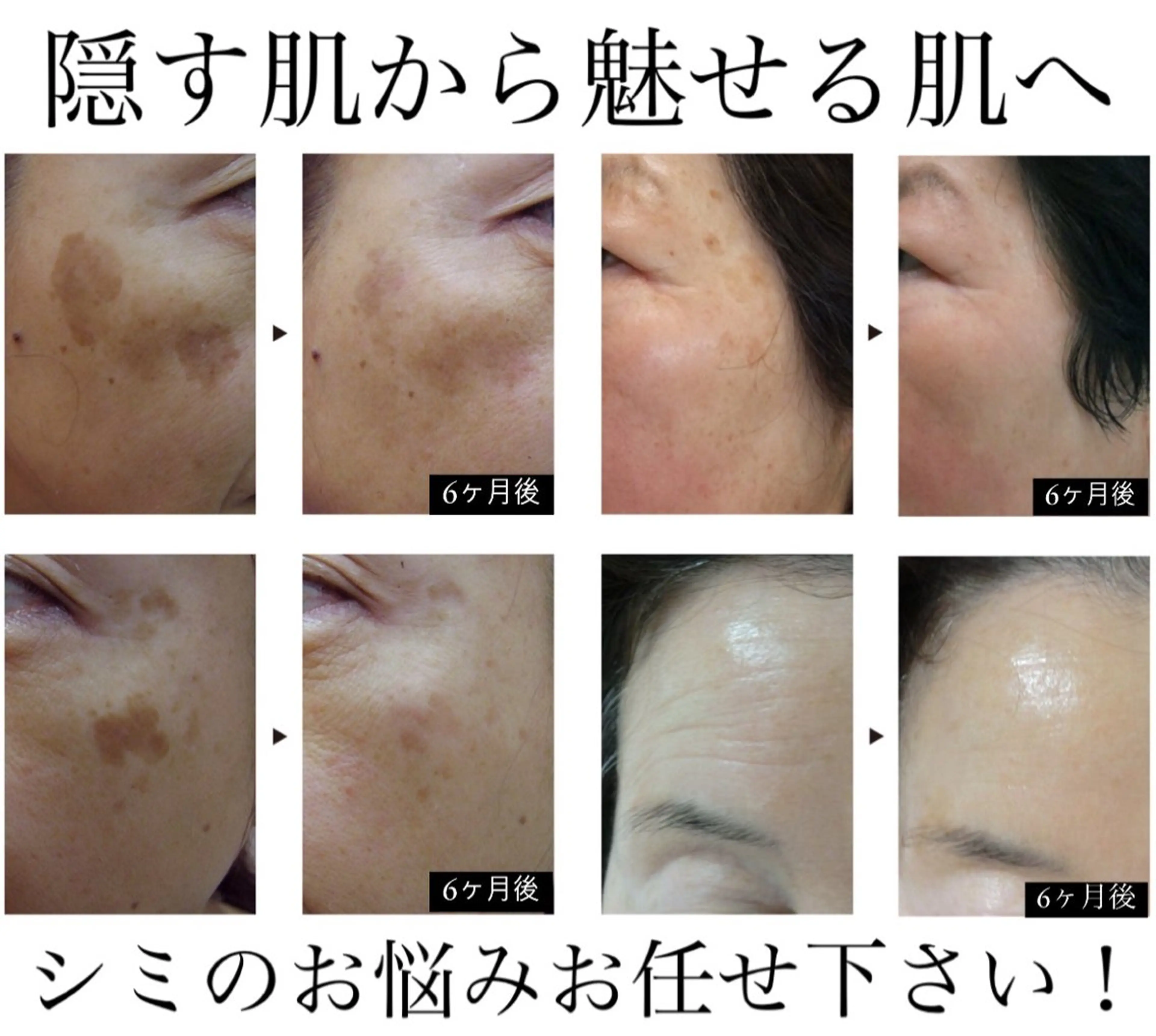 エステ リラク シミ毛穴専門店 yucca(ユッカ)のエステ・リラクイメージ