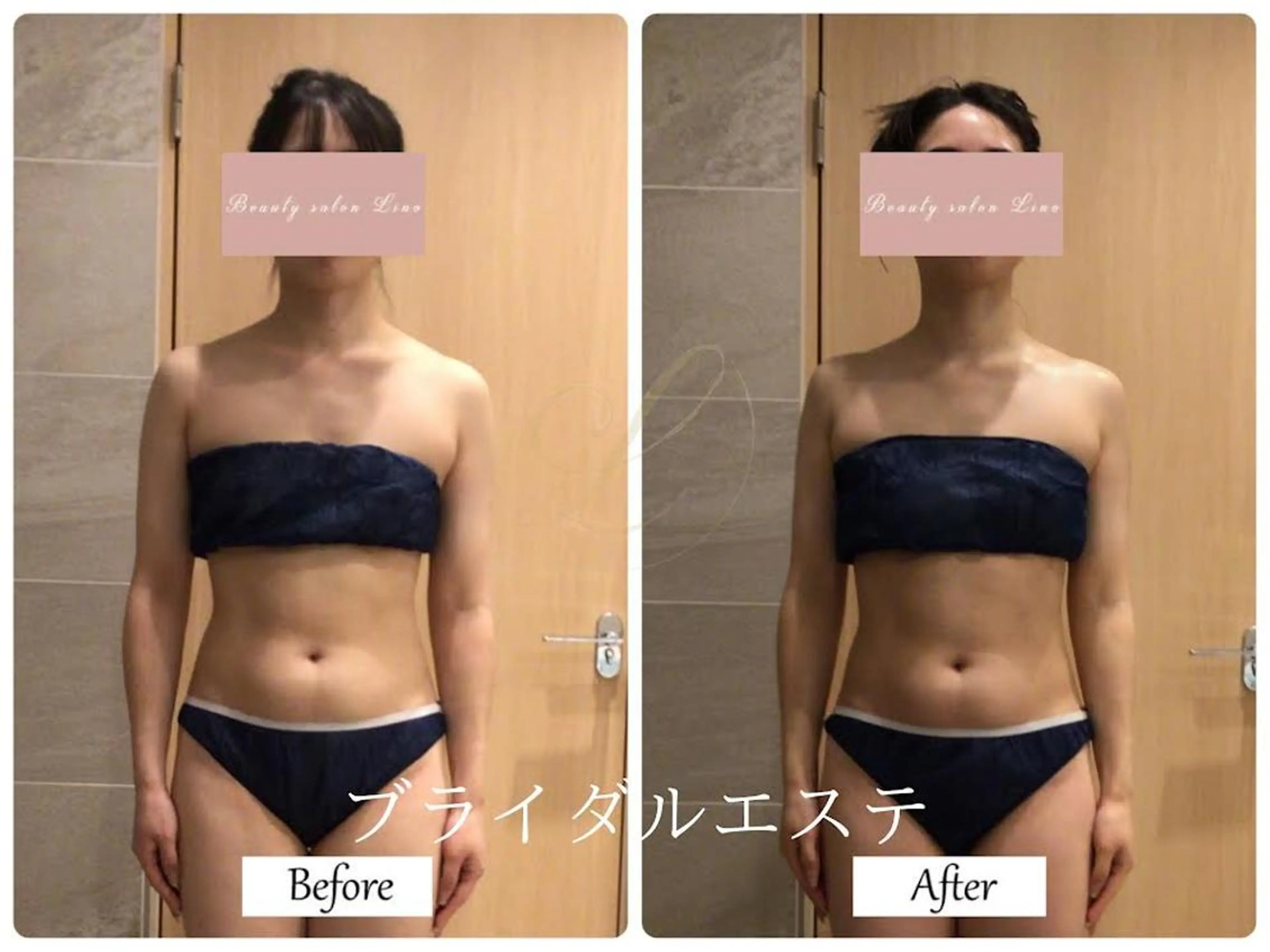 エステ リラク ブライダルサロン ｜Lino【堀江】のエステ・リラクイメージ