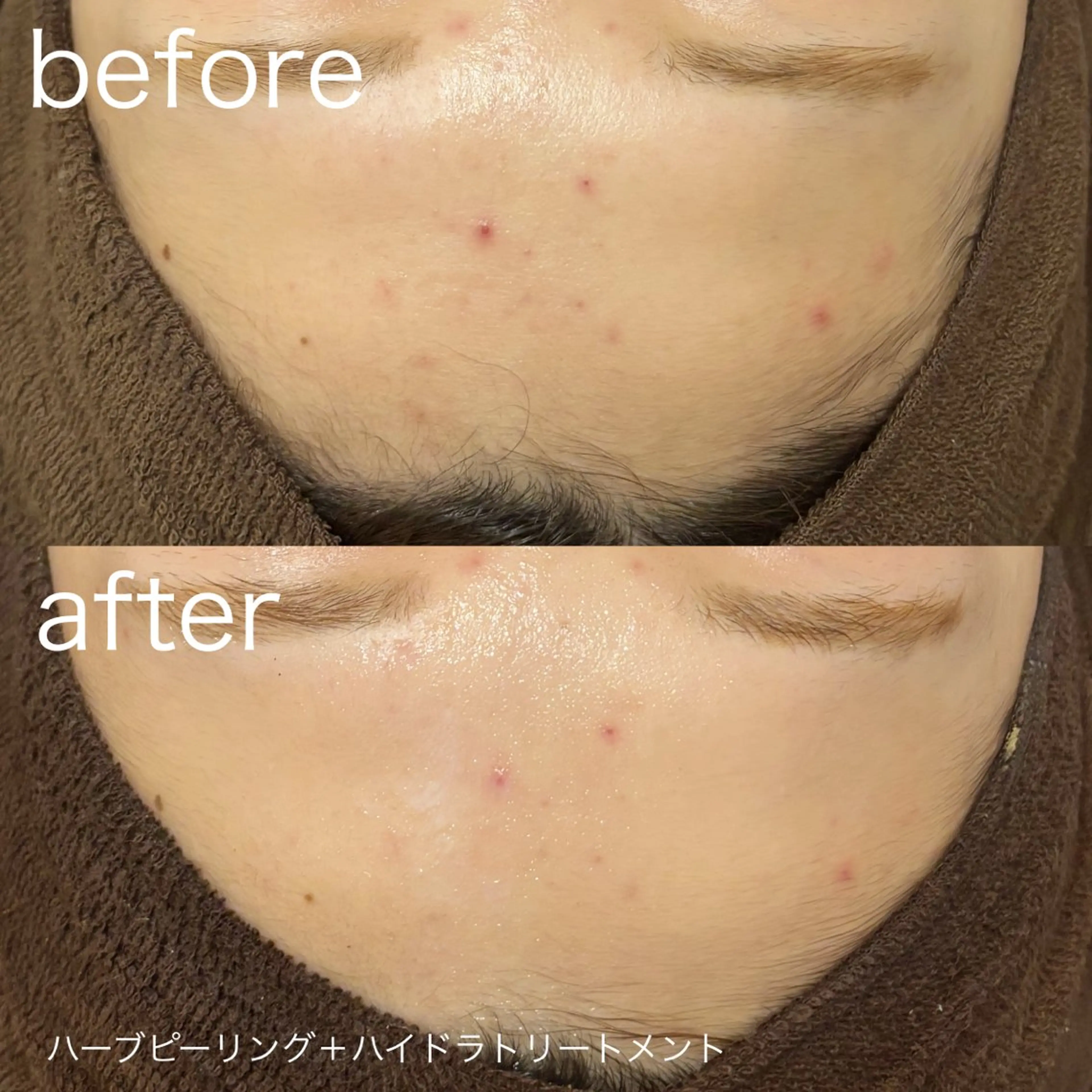 脱毛 lulularico Yuのエステ・リラクイメージ