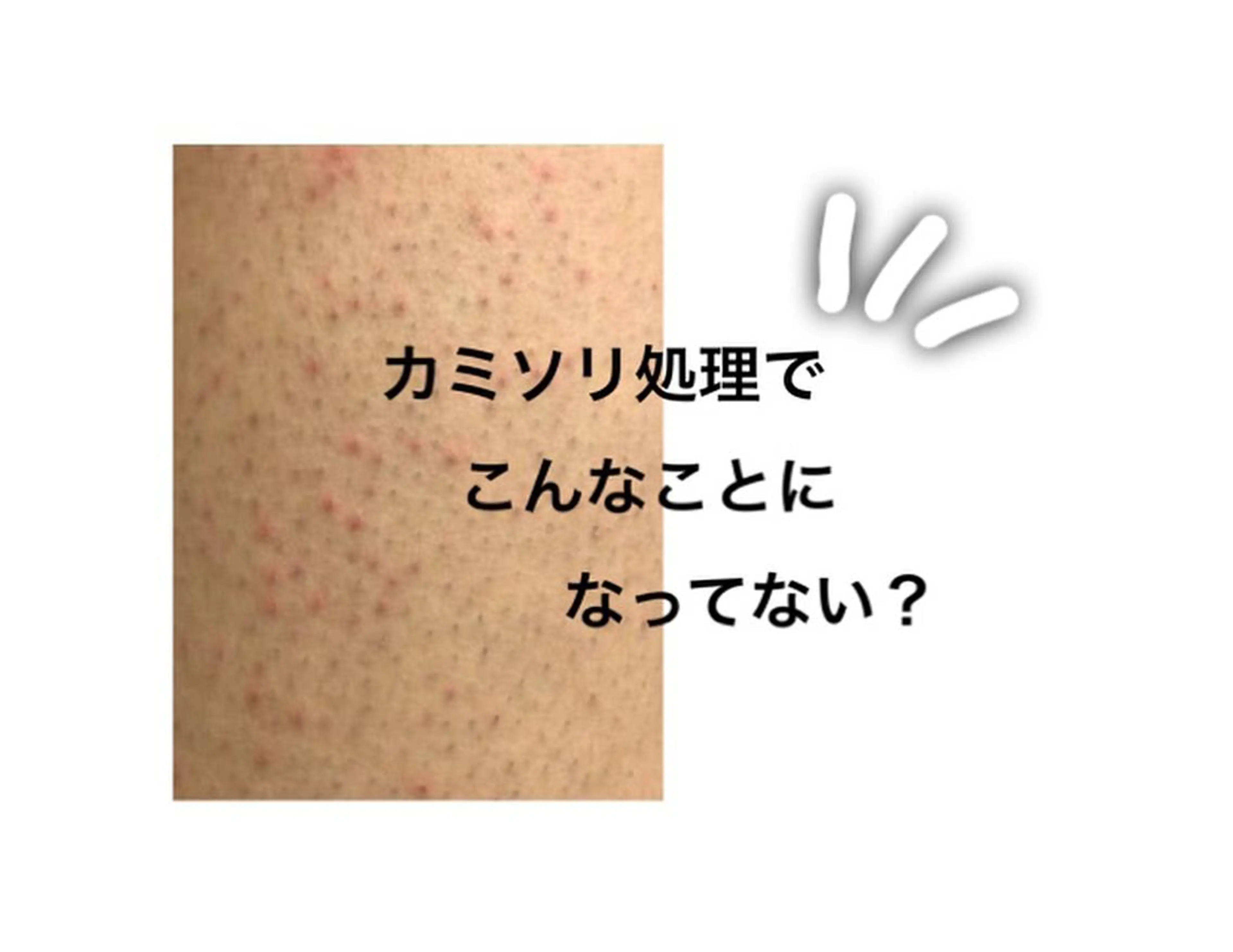 地上のトレチカ sugaringのエステ・リラクイメージ