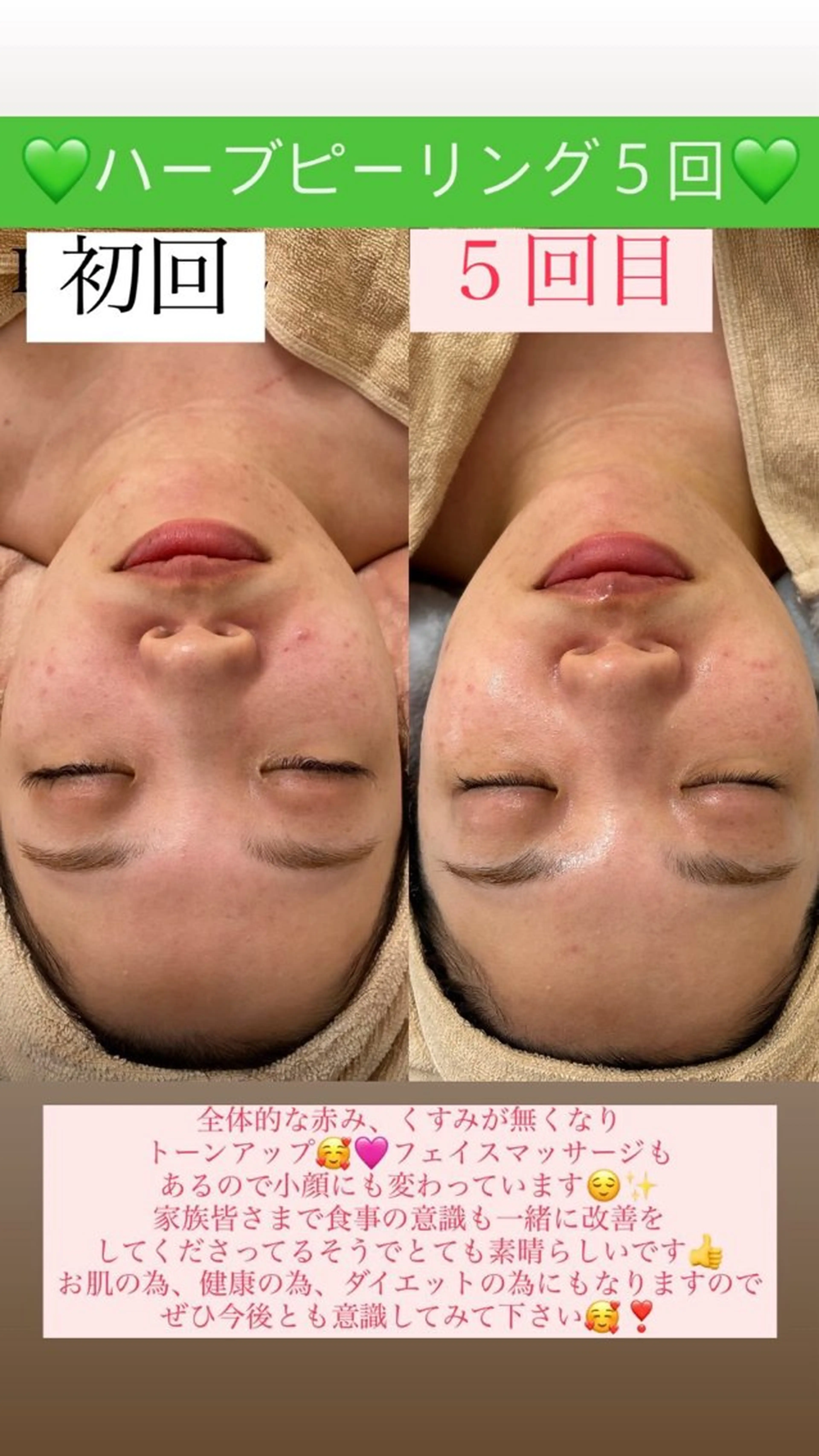 メンズ エステ Salon de Lino 御器所のエステ・リラクイメージ