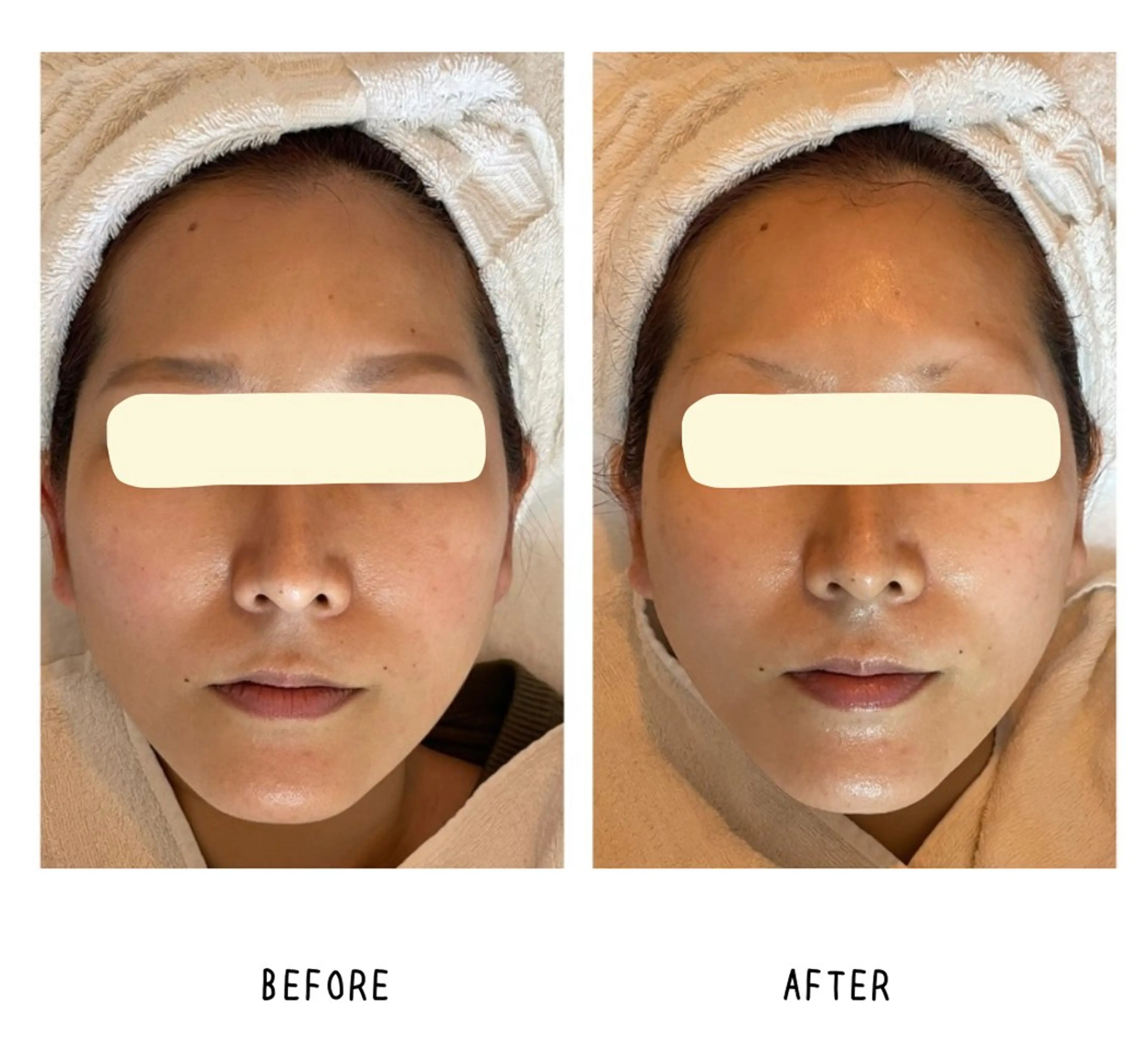 grow所属・Yoshino Erinaのエステ・リラクイメージ