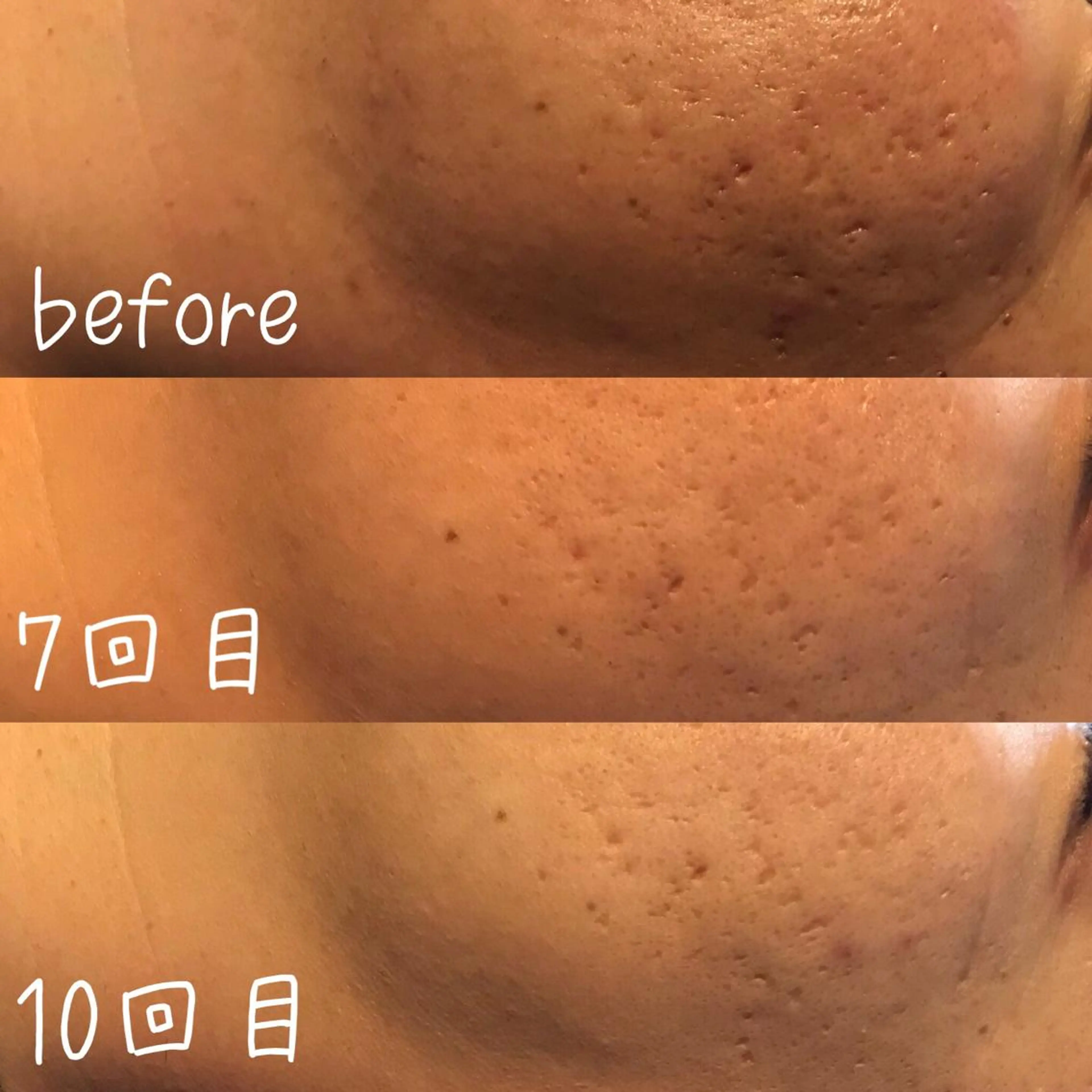 脱毛 浜野 恵美のエステ・リラクイメージ