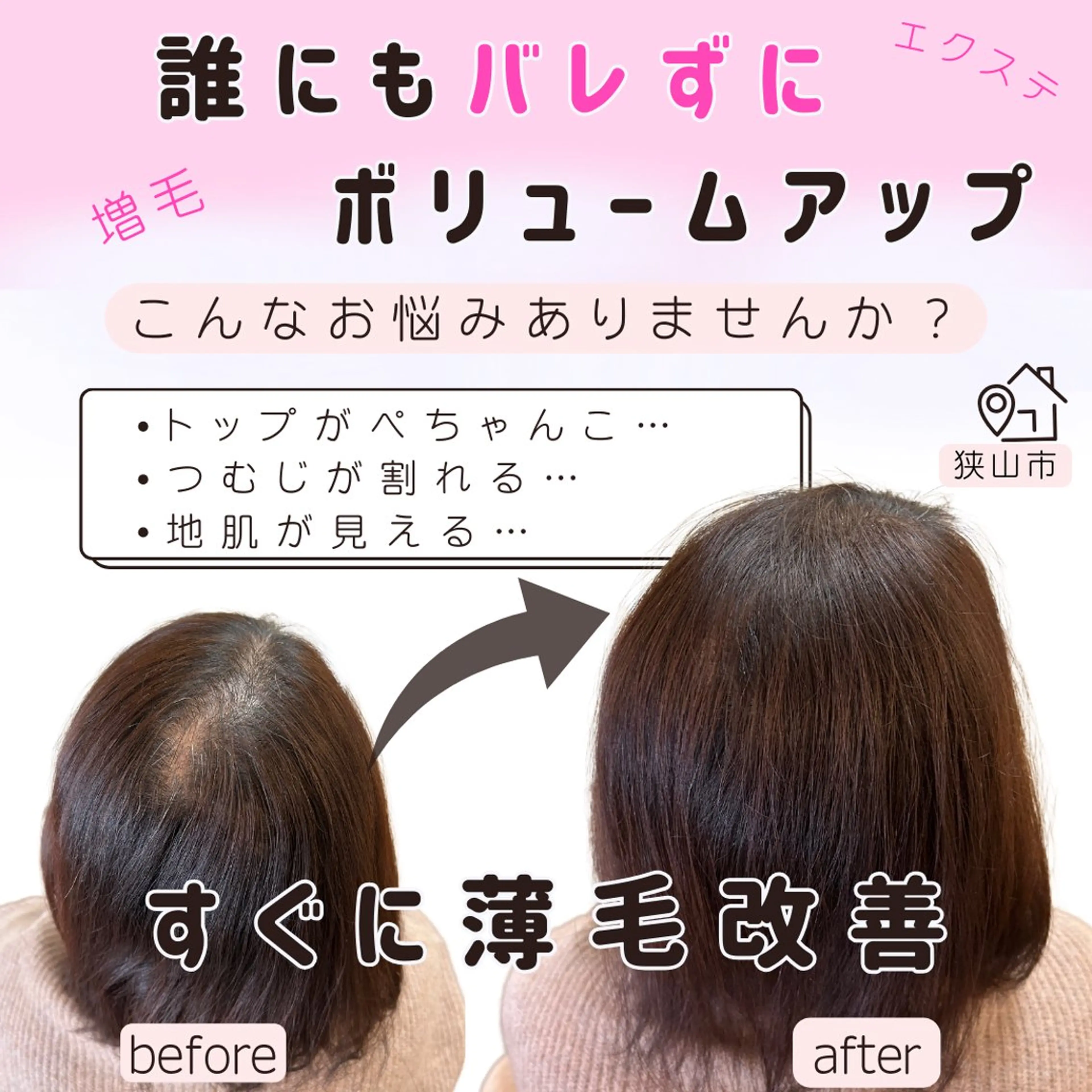 【ご新規様限定】すぐに薄毛改善❣️結び目が細かく誰にもバレない増毛エクステ3００本！シャンプーやカラー普段通り生活OK!の写真