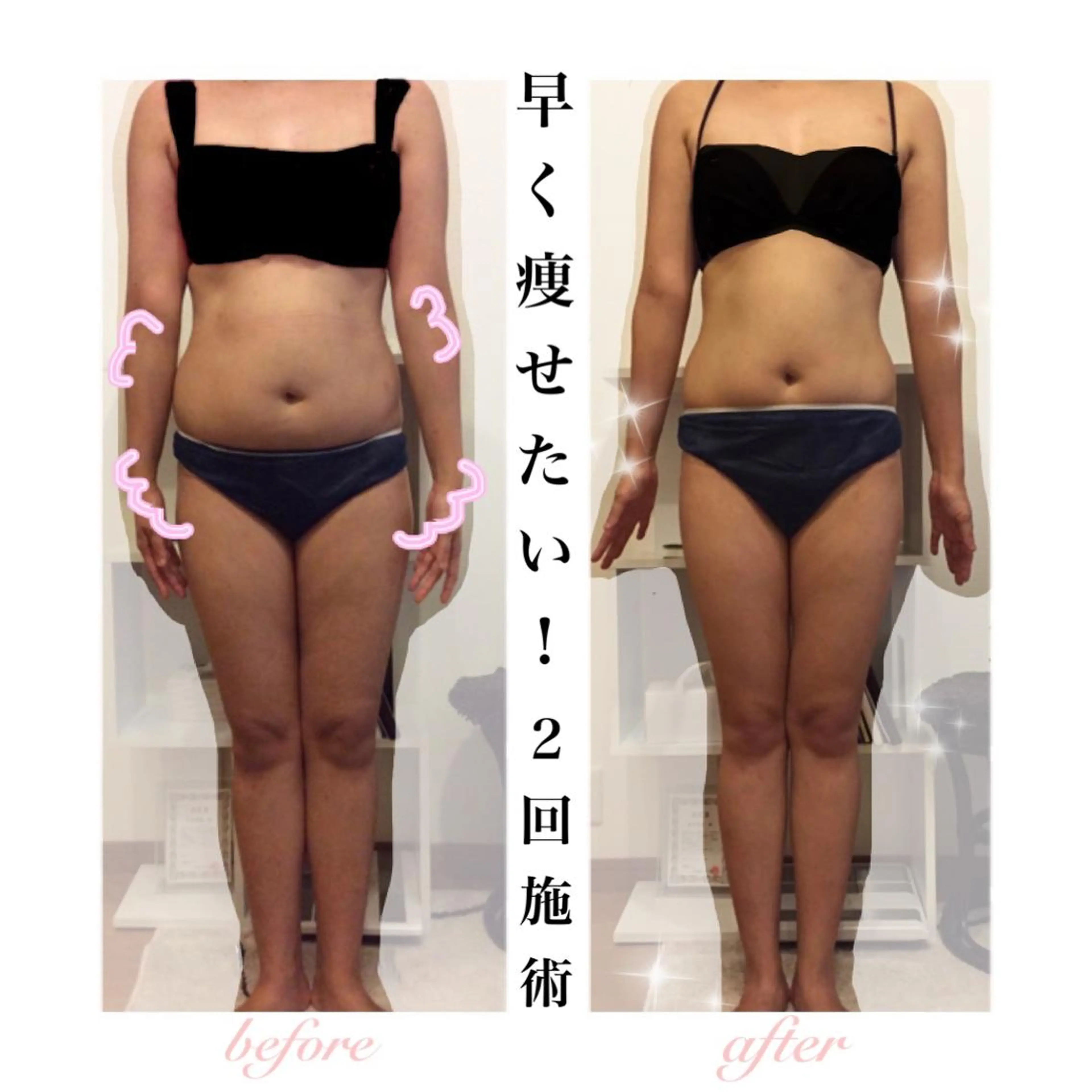 エステ リラク ダイエット・美肌ケア fleurのエステ・リラクイメージ