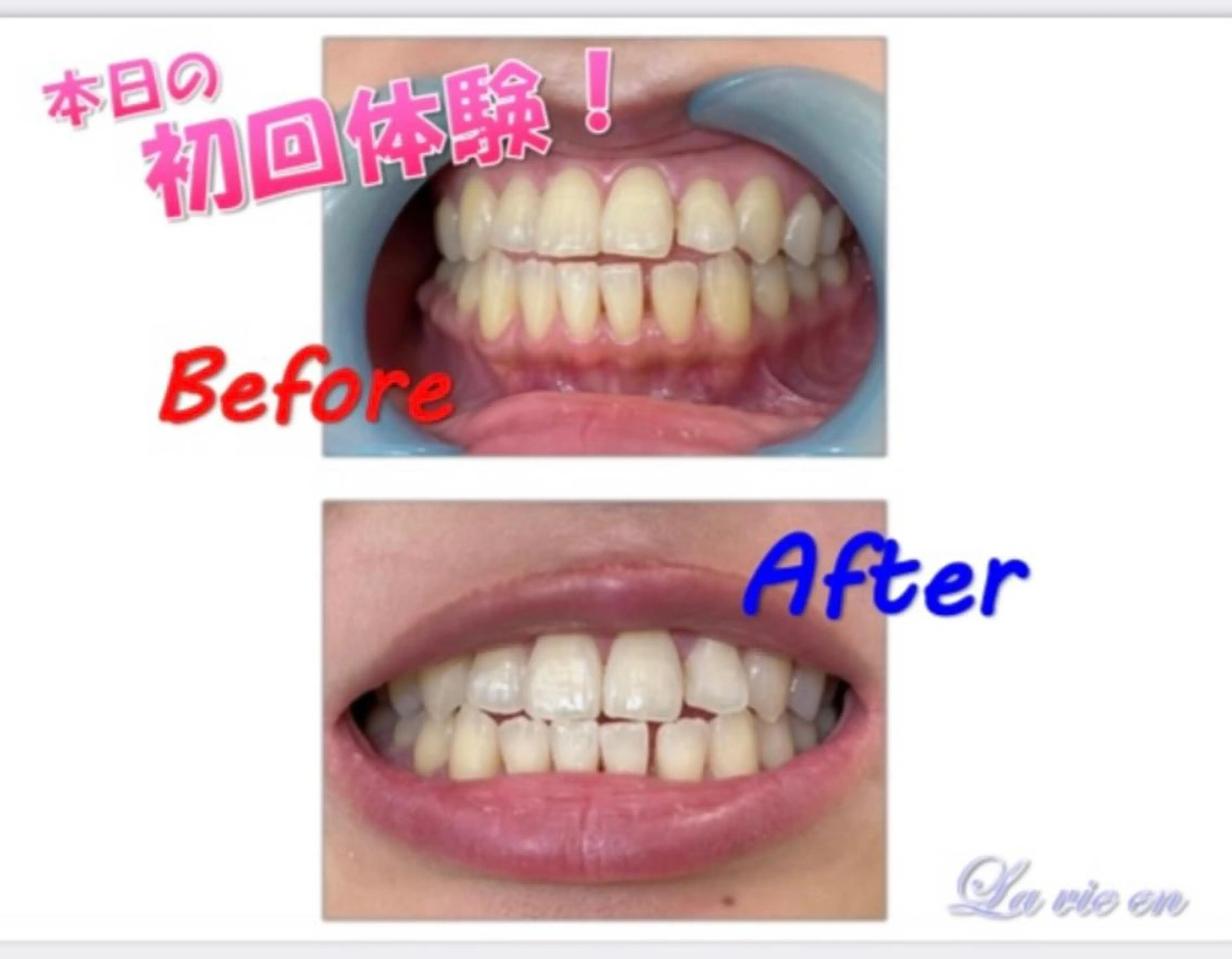 その他 セルフホワイトニングサロン　ラヴィアン所属・ホワイトニングサロン La vie enのその他イメージ