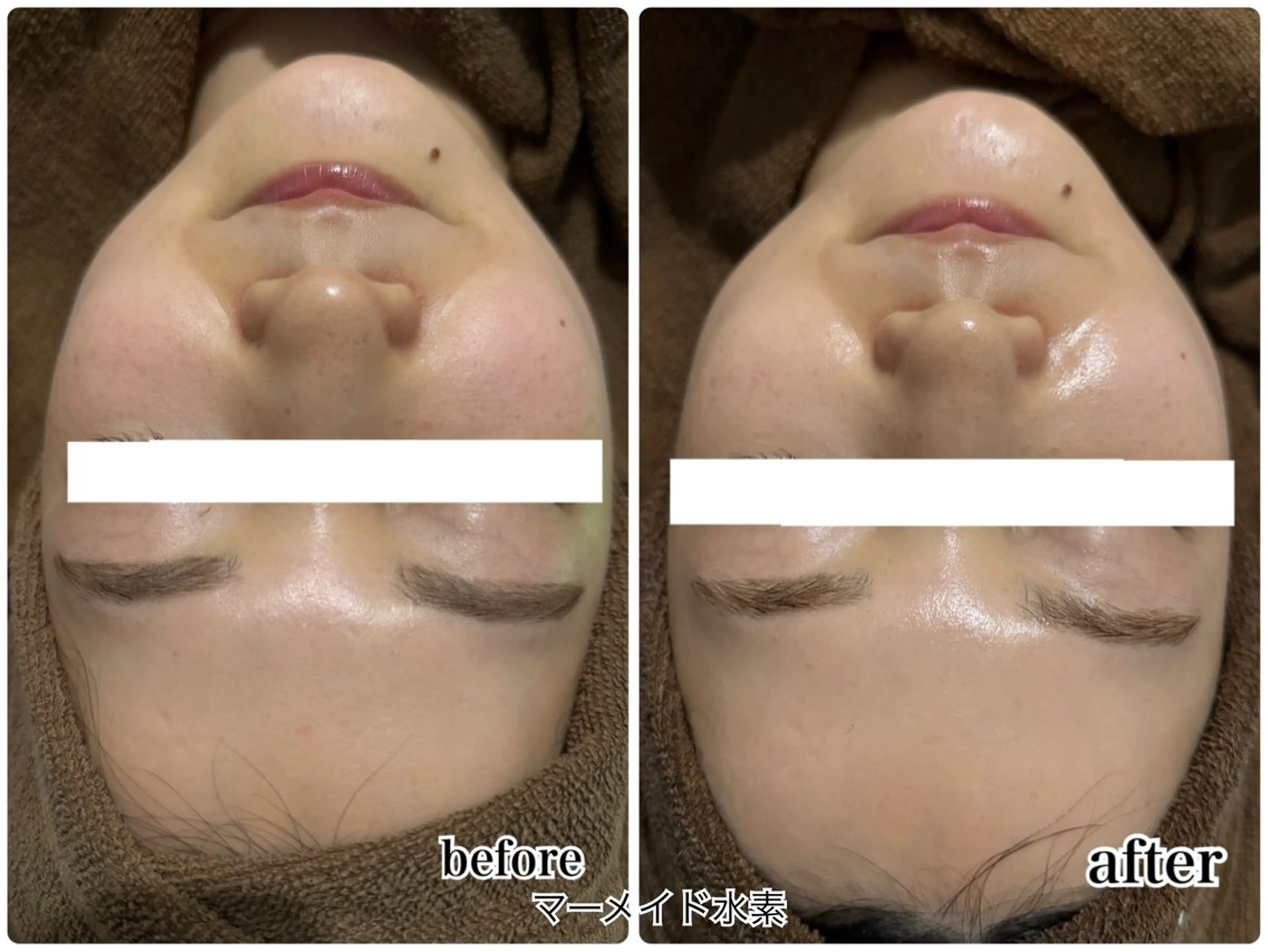 その他 ENCHANT 脱毛.小顔.毛穴のエステ・リラクイメージ