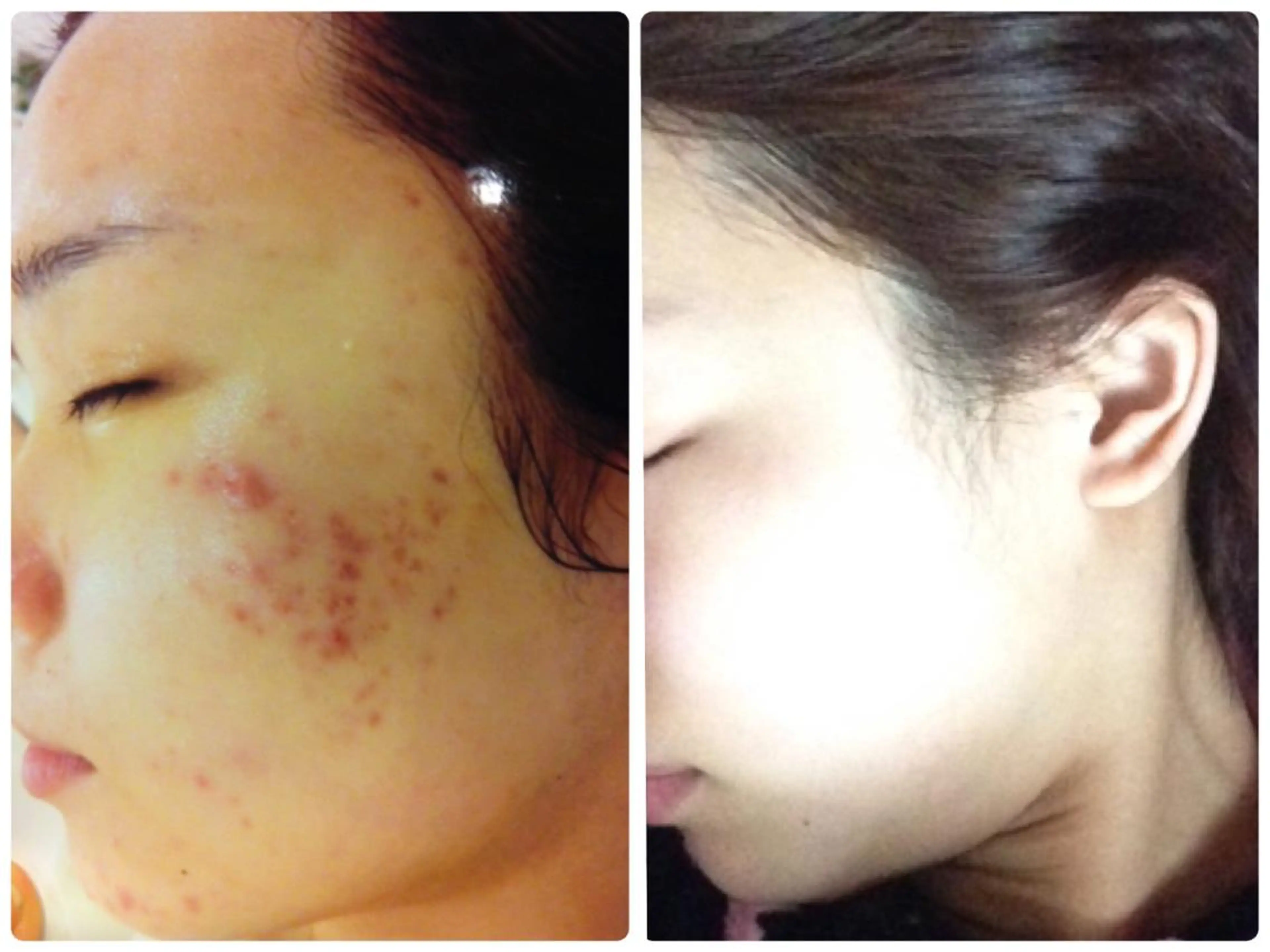 都度払い肌質改善 &脱毛Blancheのエステ・リラクイメージ