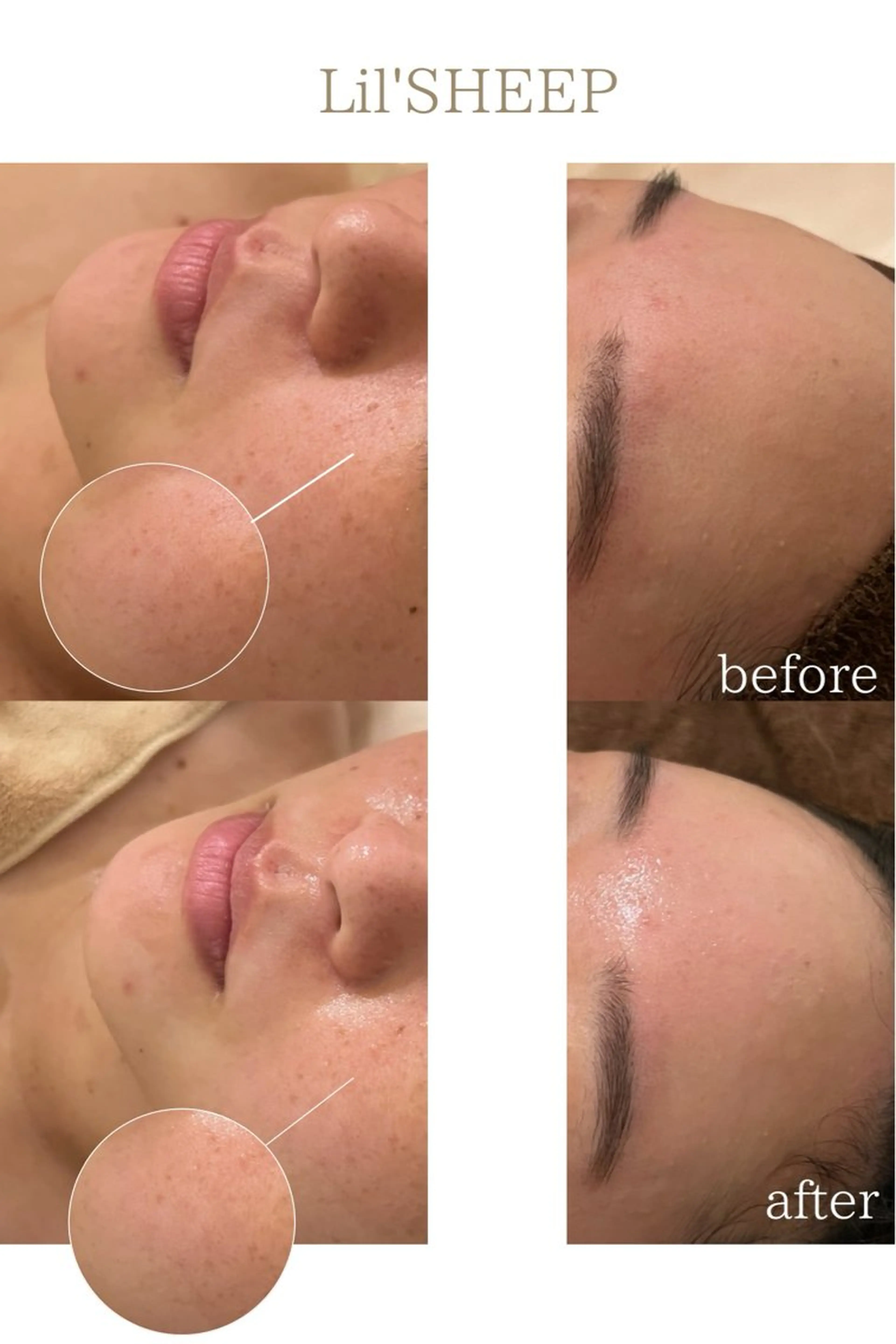 エステ 小嶋萌 今池駅徒歩2分のエステ・リラクイメージ