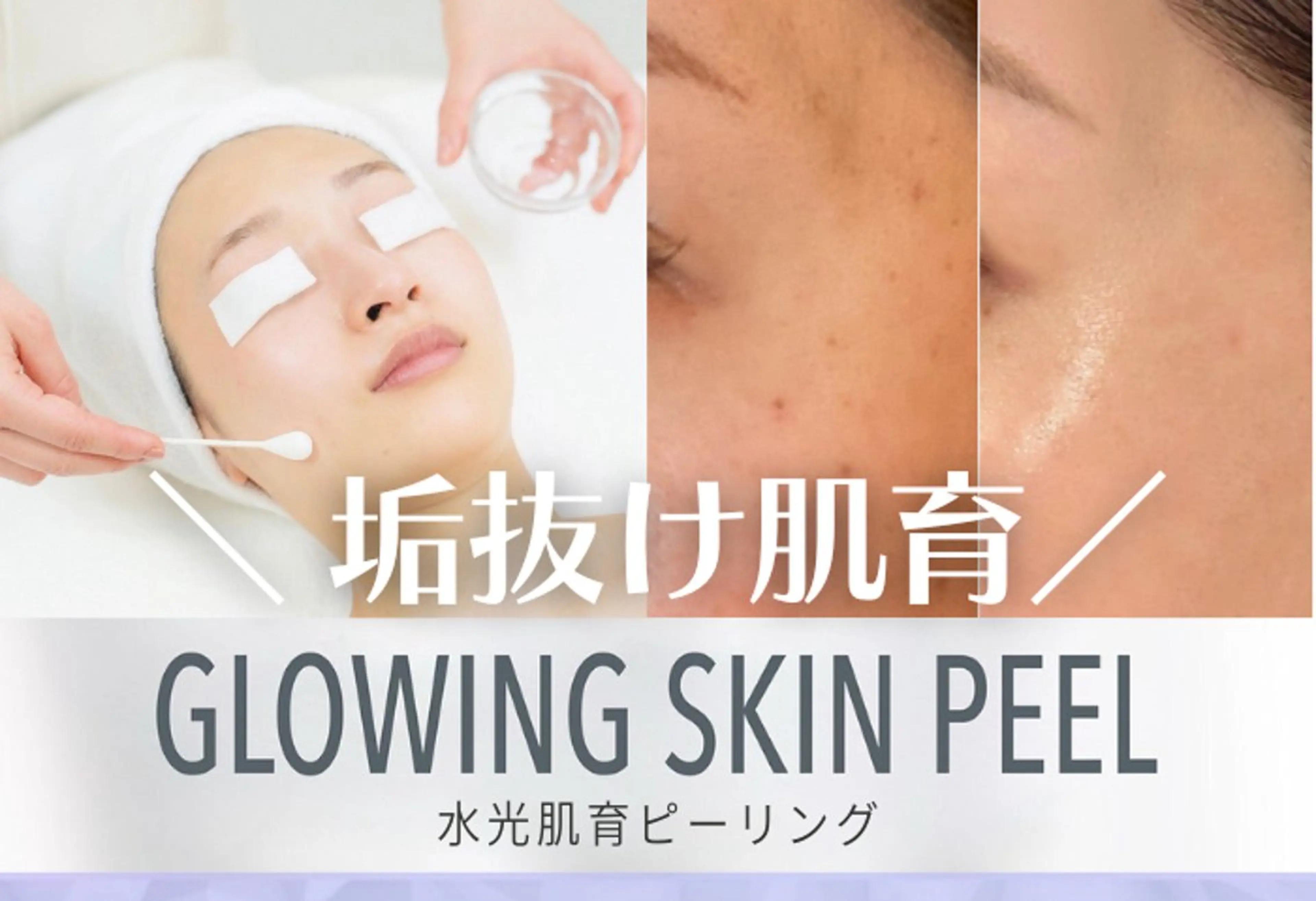 今だけ限定50%OFF❗️当店人気No.1‼️【水光肌育ピーリング90分】¥9,900の写真