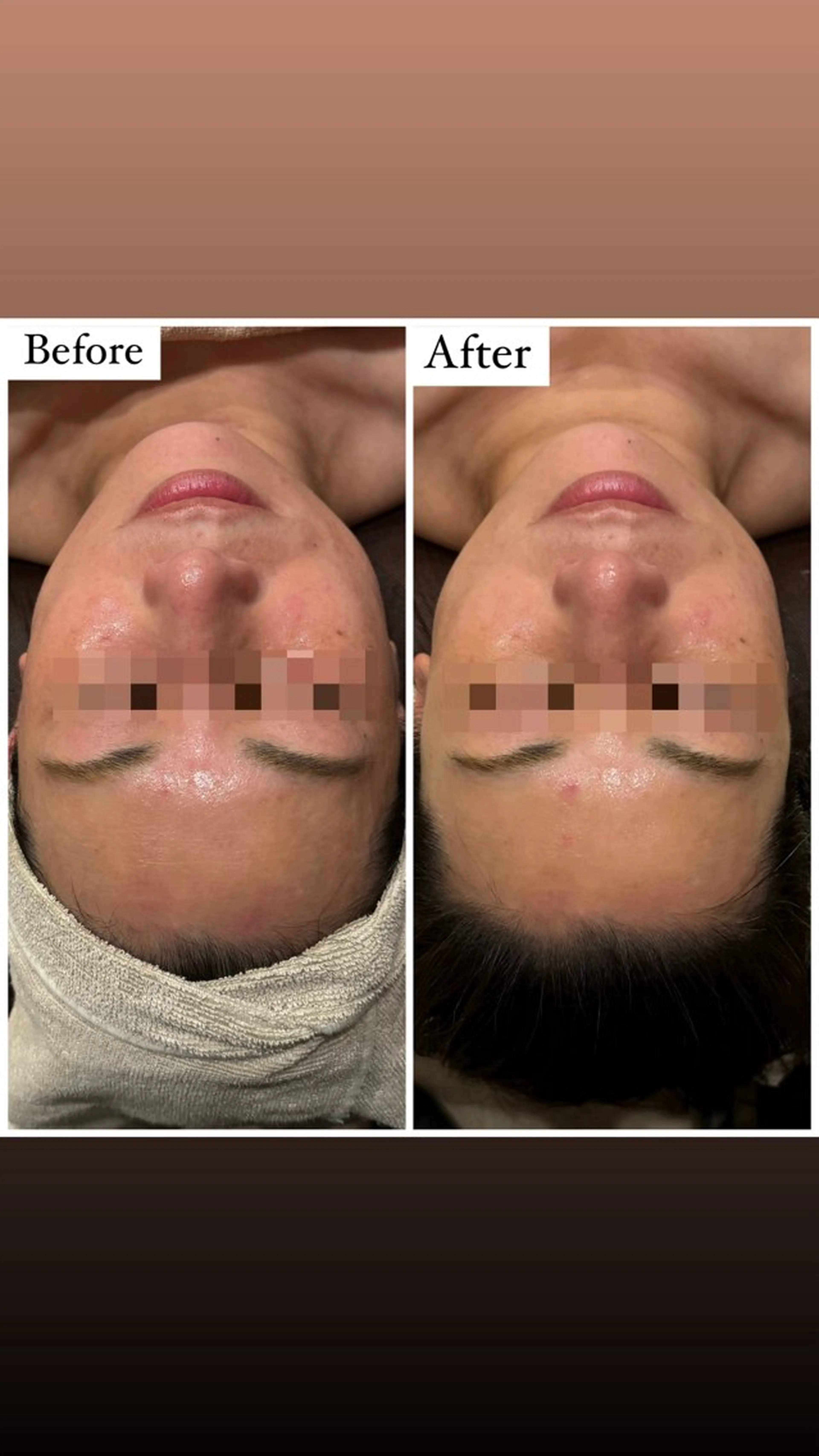 ハーブピーリング専門 muro.のエステ・リラクイメージ