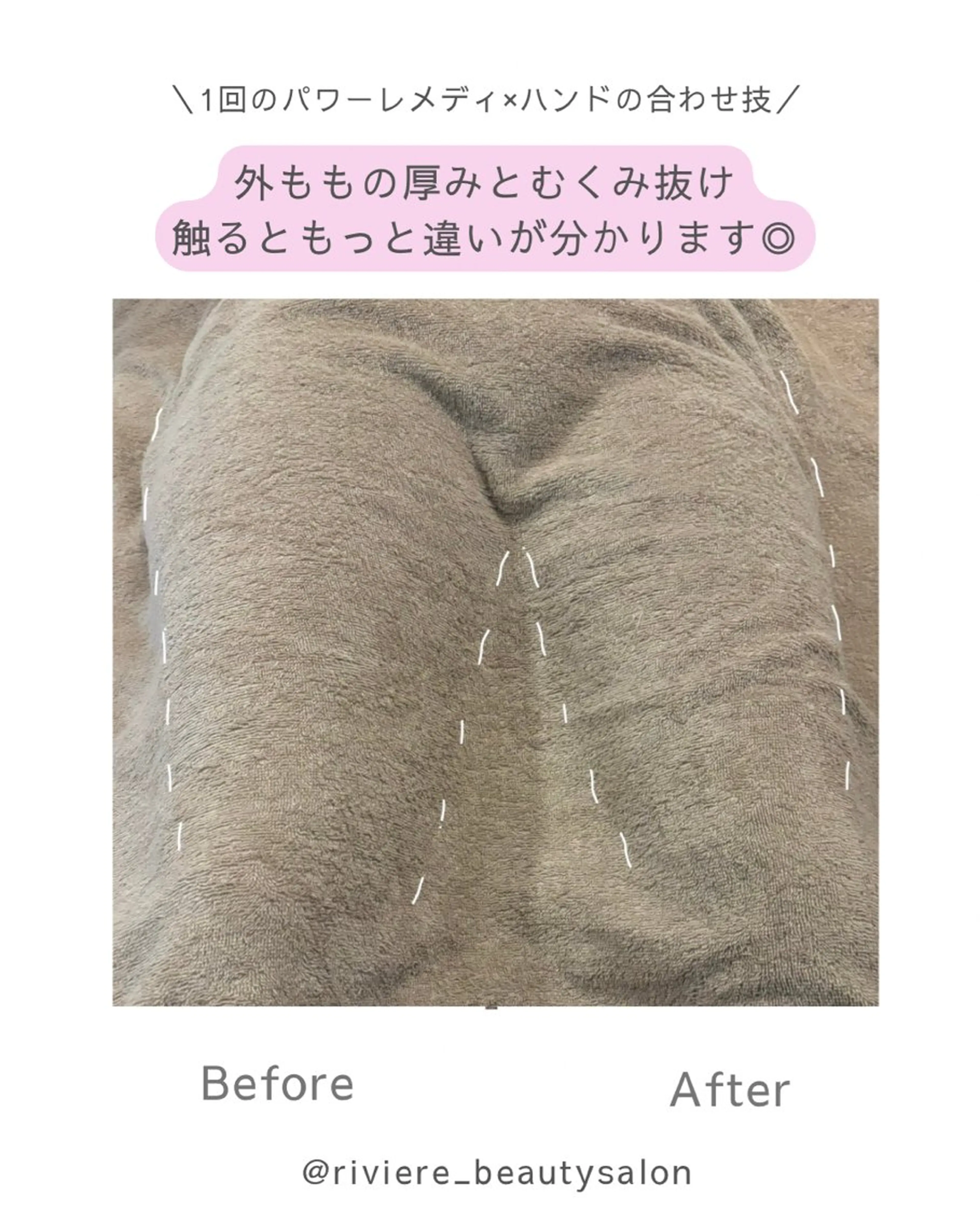 . Reのエステ・リラクイメージ