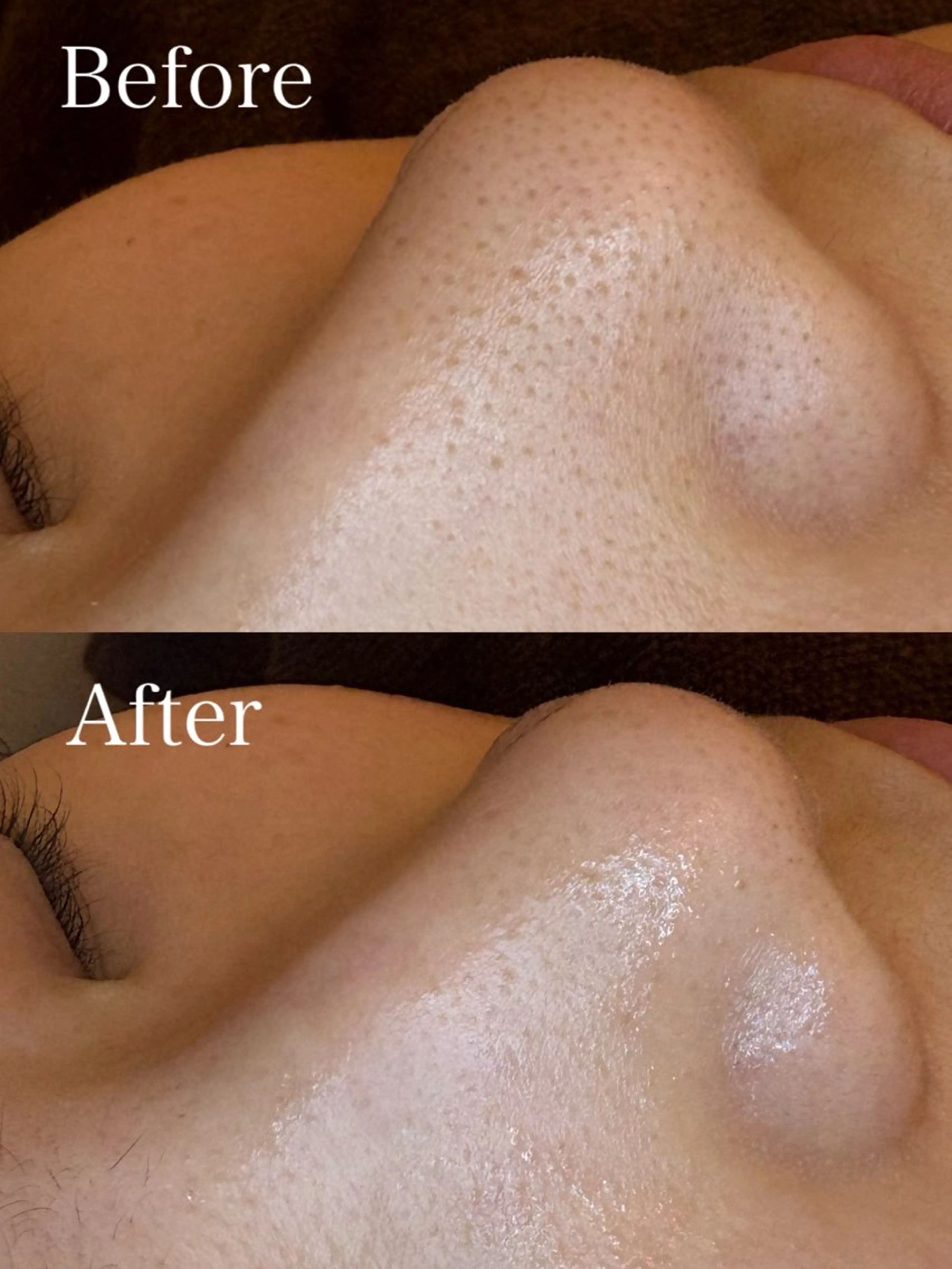 エステ EARTH coiffure beaute 新潟紫竹山店所属・🤍アベシュリ /フェイシャル🤍のエステ・リラクイメージ