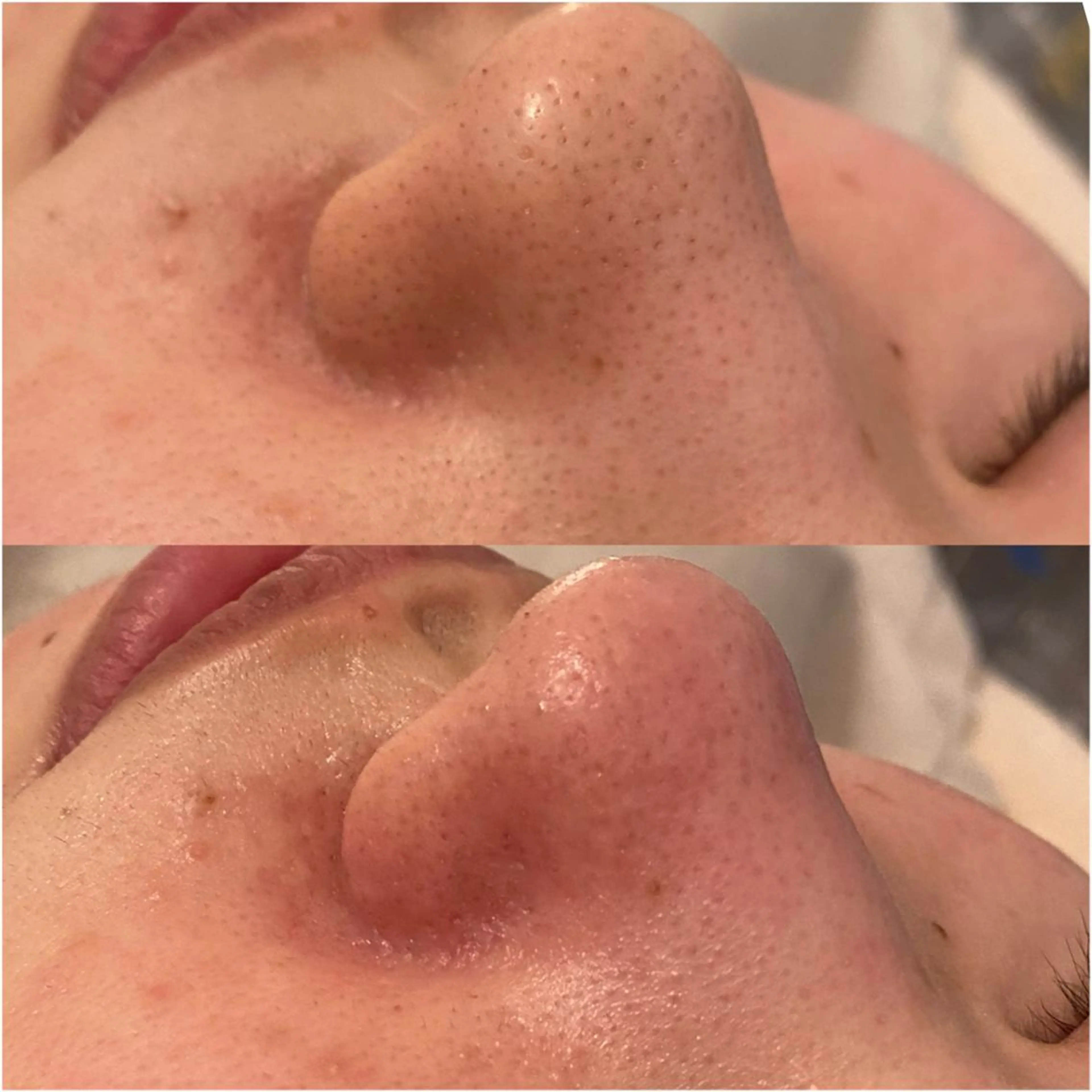 ✨美肌水光✨ アトリエリュバンのエステ・リラクイメージ