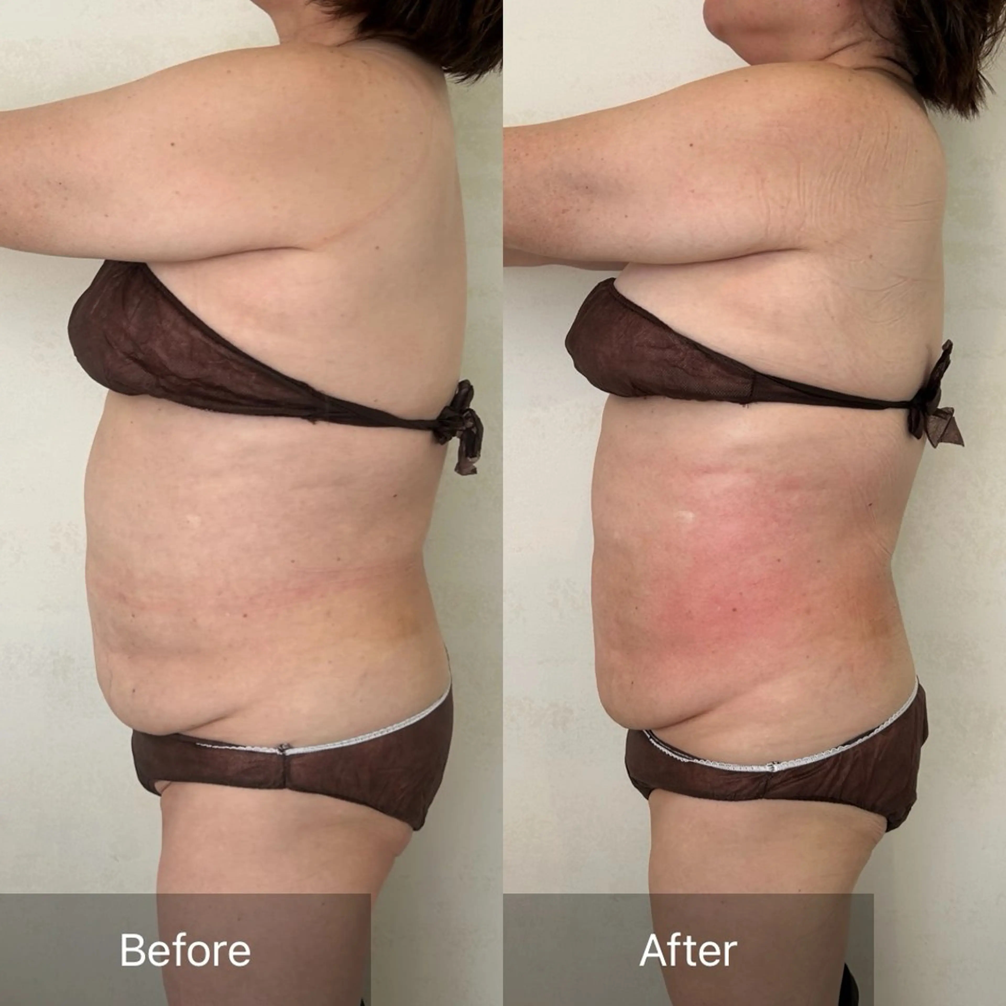 初回最強痩身レモン🍋10ccの写真