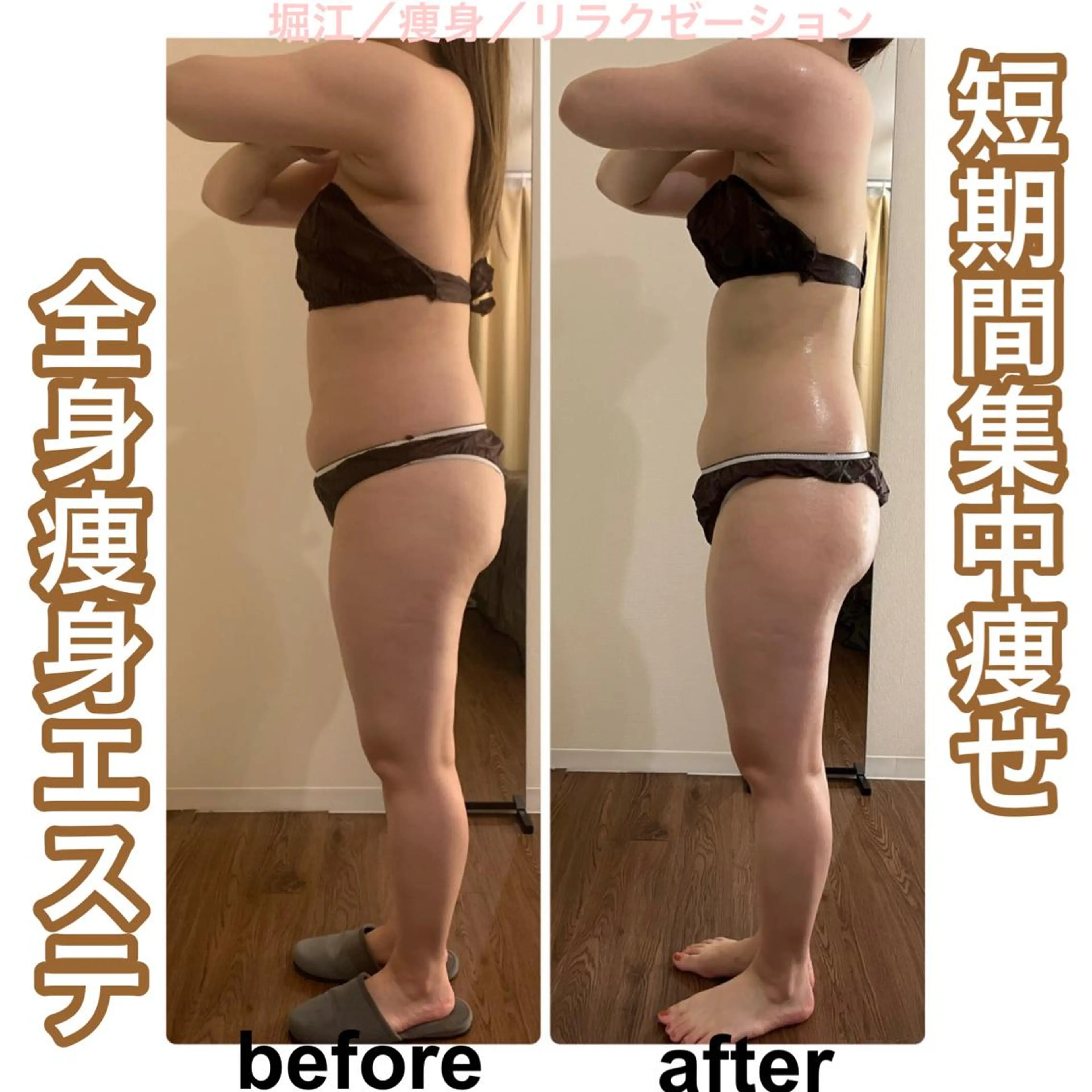 エステ bellissimo 【ベリッシモ】所属・ちひろ　痩身/ハーブ bellissimoのエステ・リラクイメージ