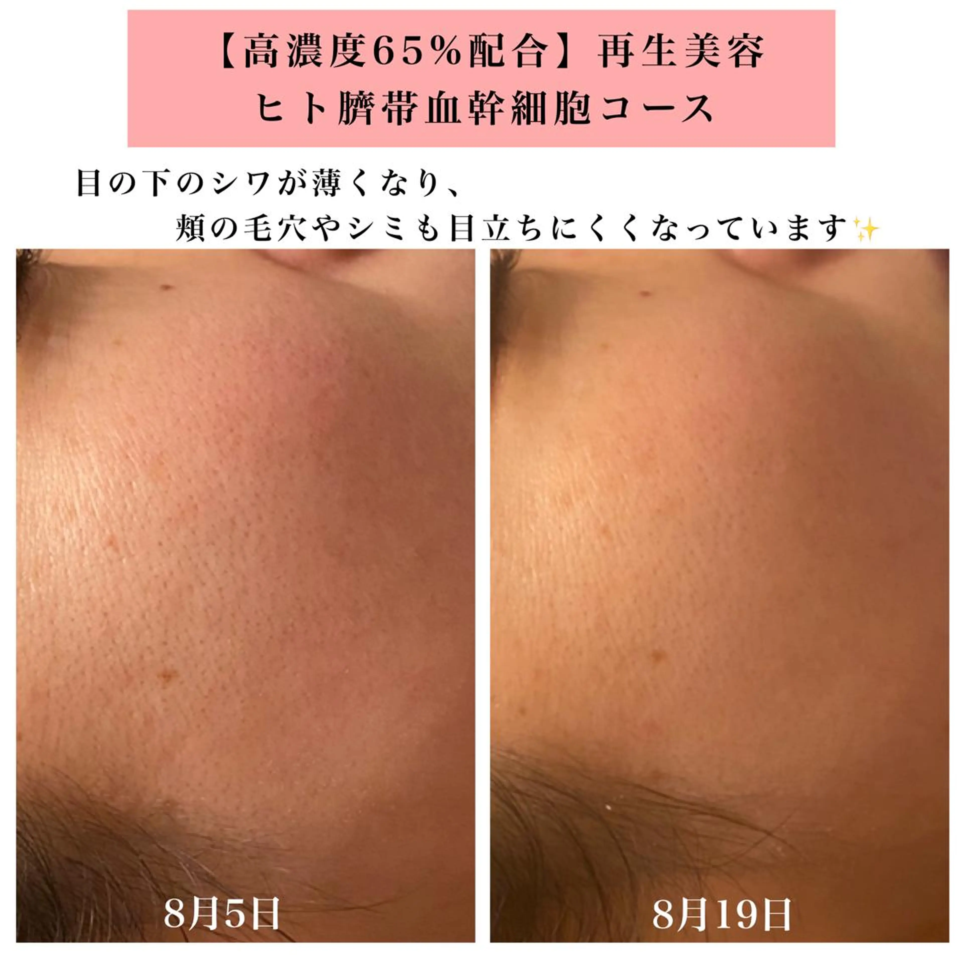 エステ リラク Bellesthe （ベルエステ）のエステ・リラクイメージ