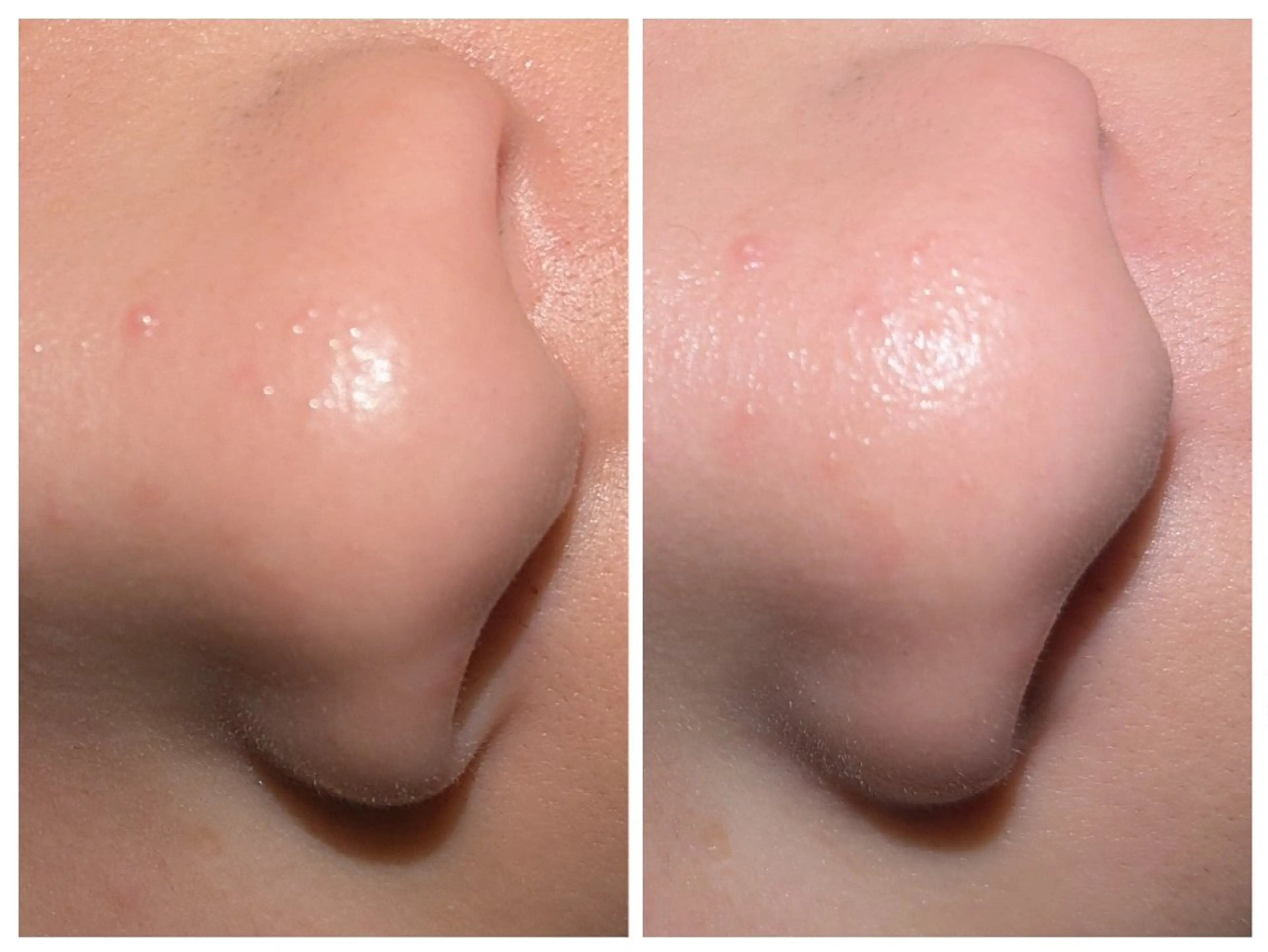 エステ AQUAサロン　AKALA所属・巡 (Meguri)のエステ・リラクイメージ