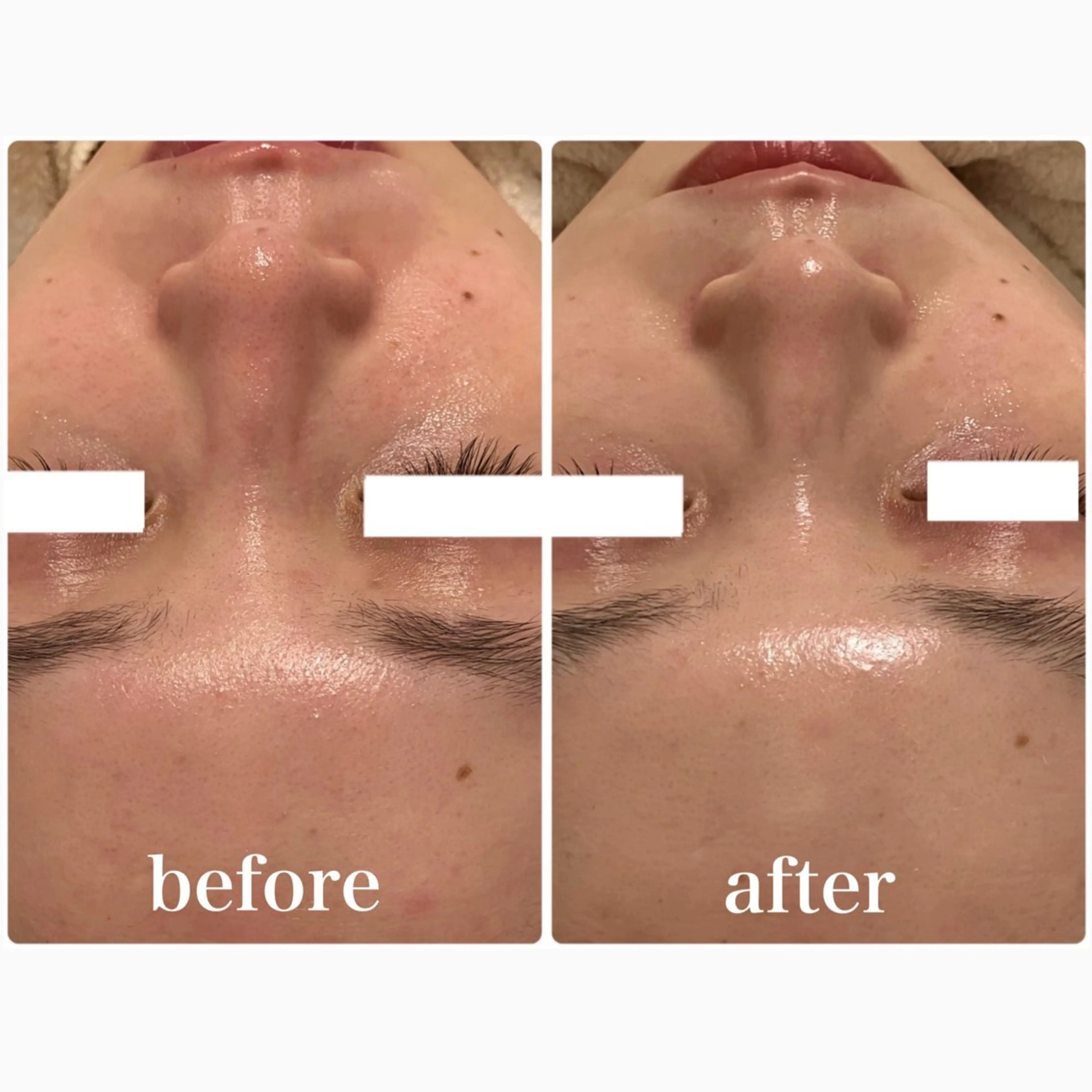 Lily branc 痩身/小顔/肌質改善のエステ・リラクイメージ