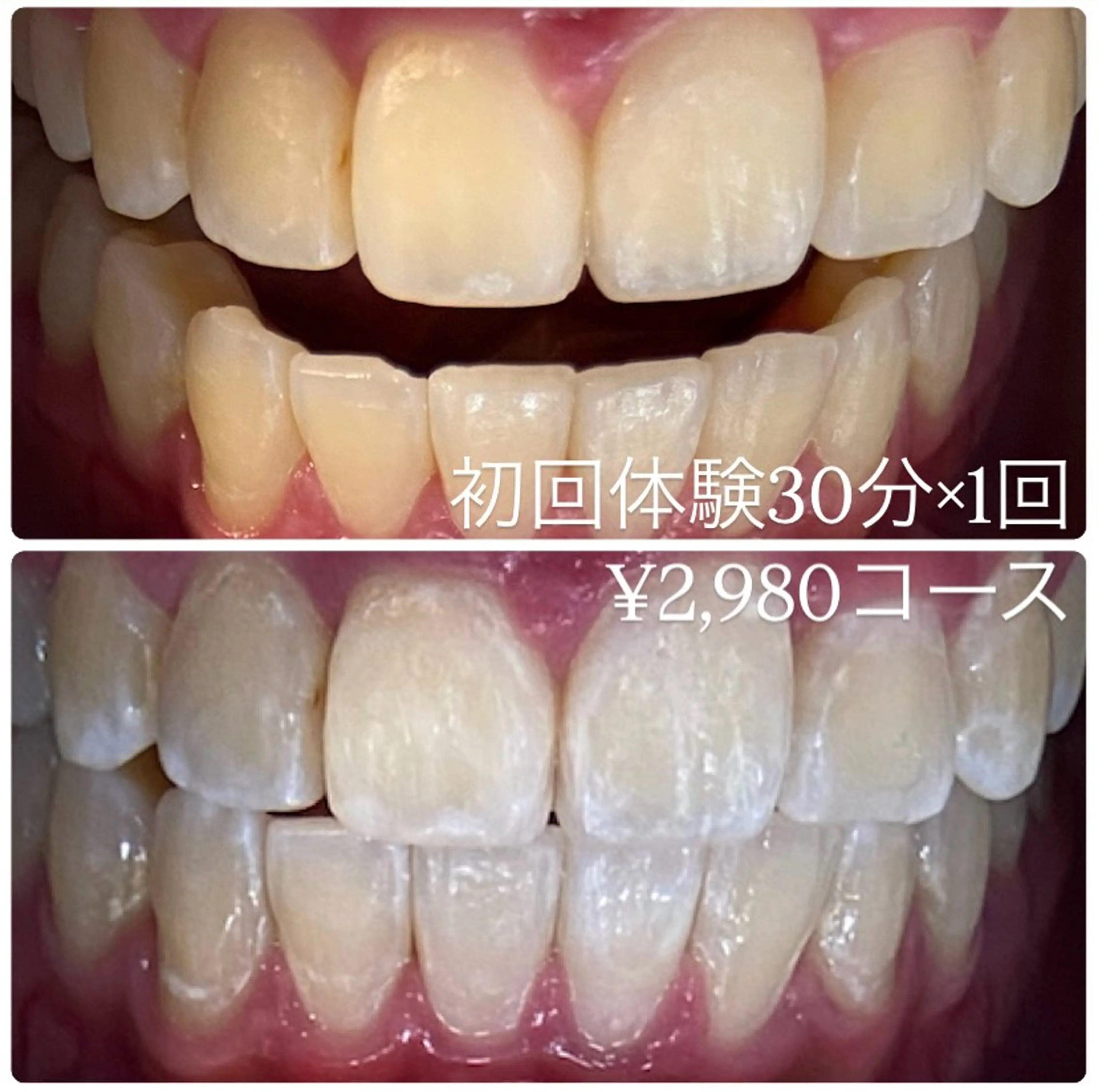 PLATINUM Beauty 横浜店所属・ホワイトニングルーム 横浜店のその他イメージ