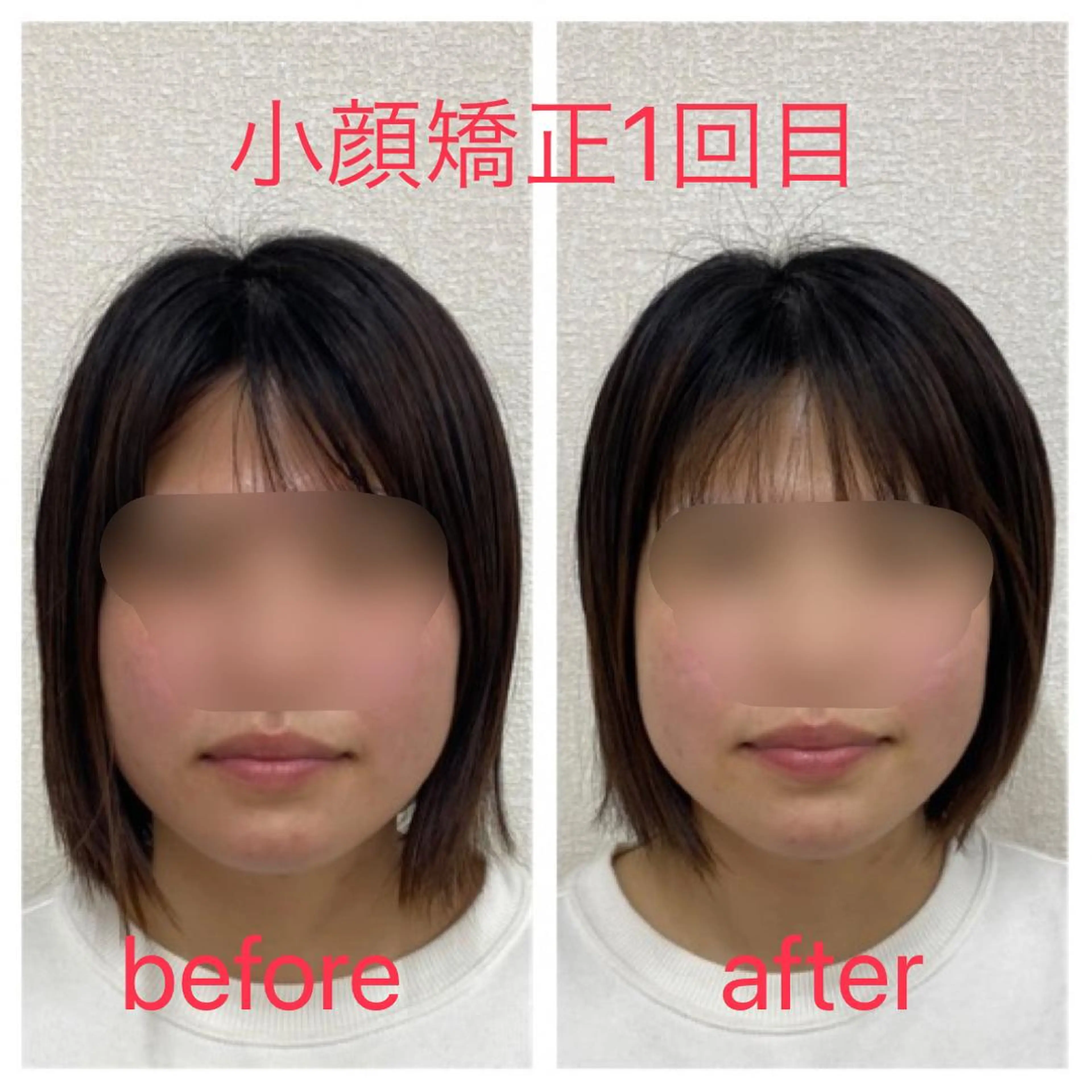 小顔矯正サロンLily所属・小顔矯正サロン Lilyのエステ・リラクイメージ