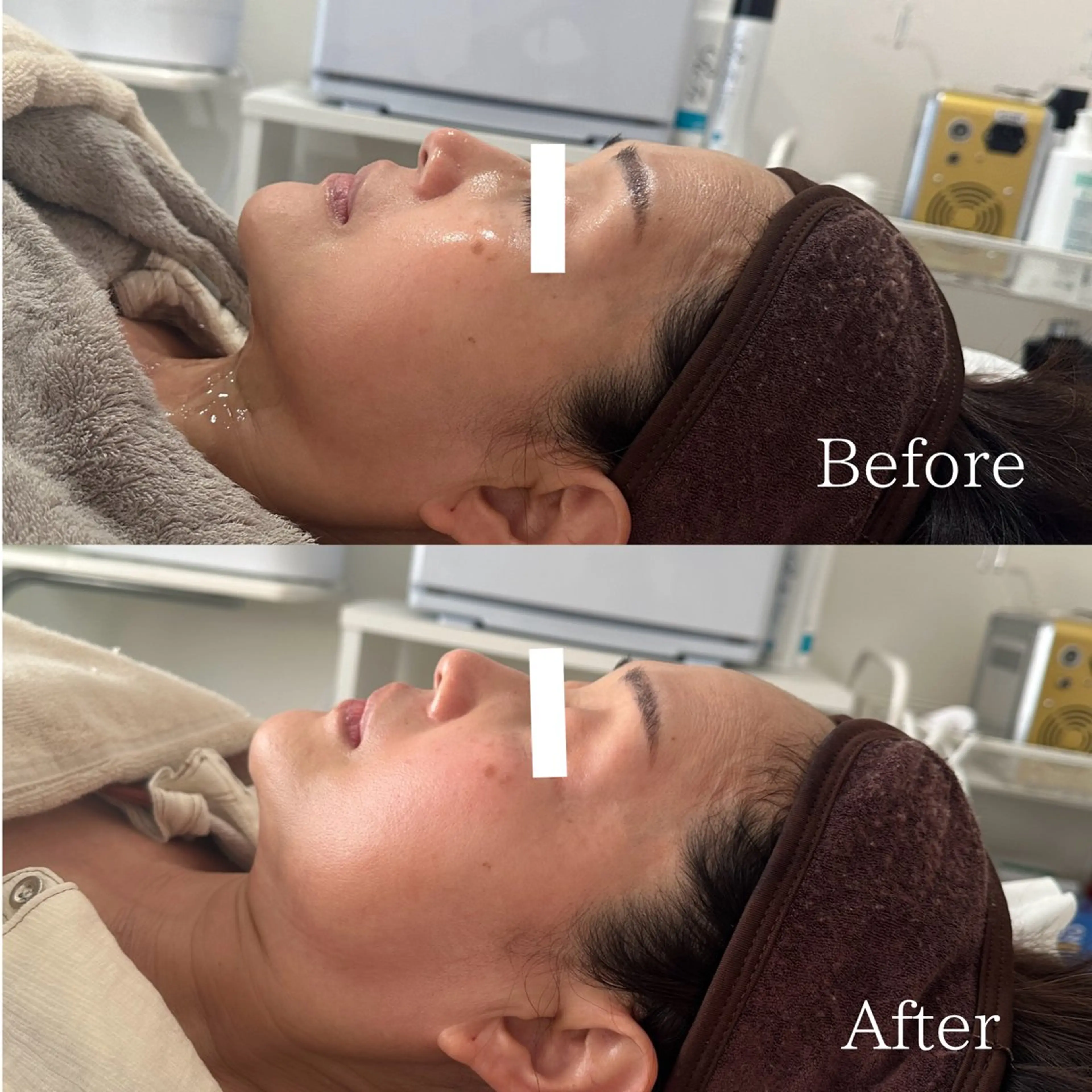 エステ lafleur Yurinaのエステ・リラクイメージ