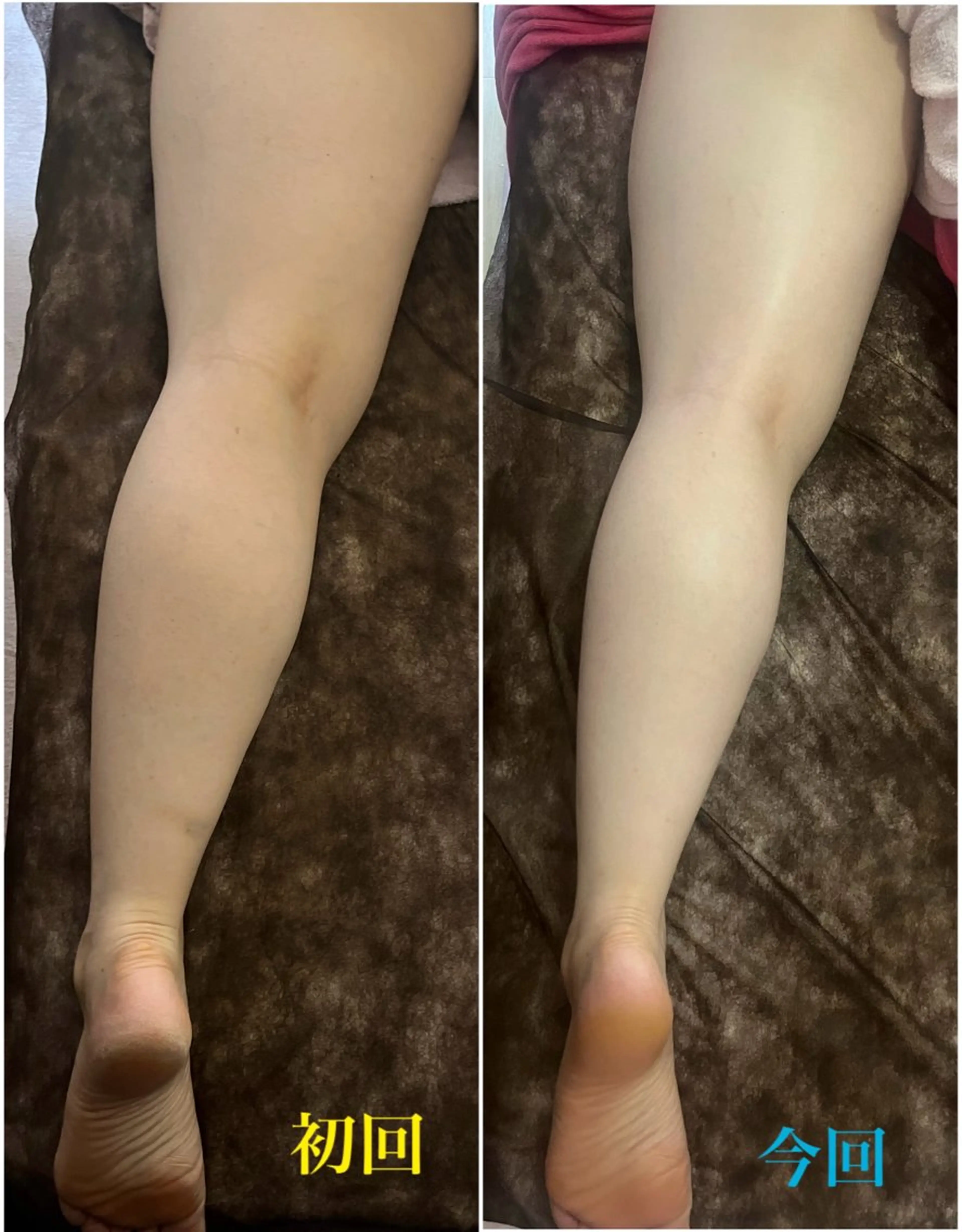 アロマ･美容鍼･カッ ピング「麗」鍼灸院のエステ・リラクイメージ