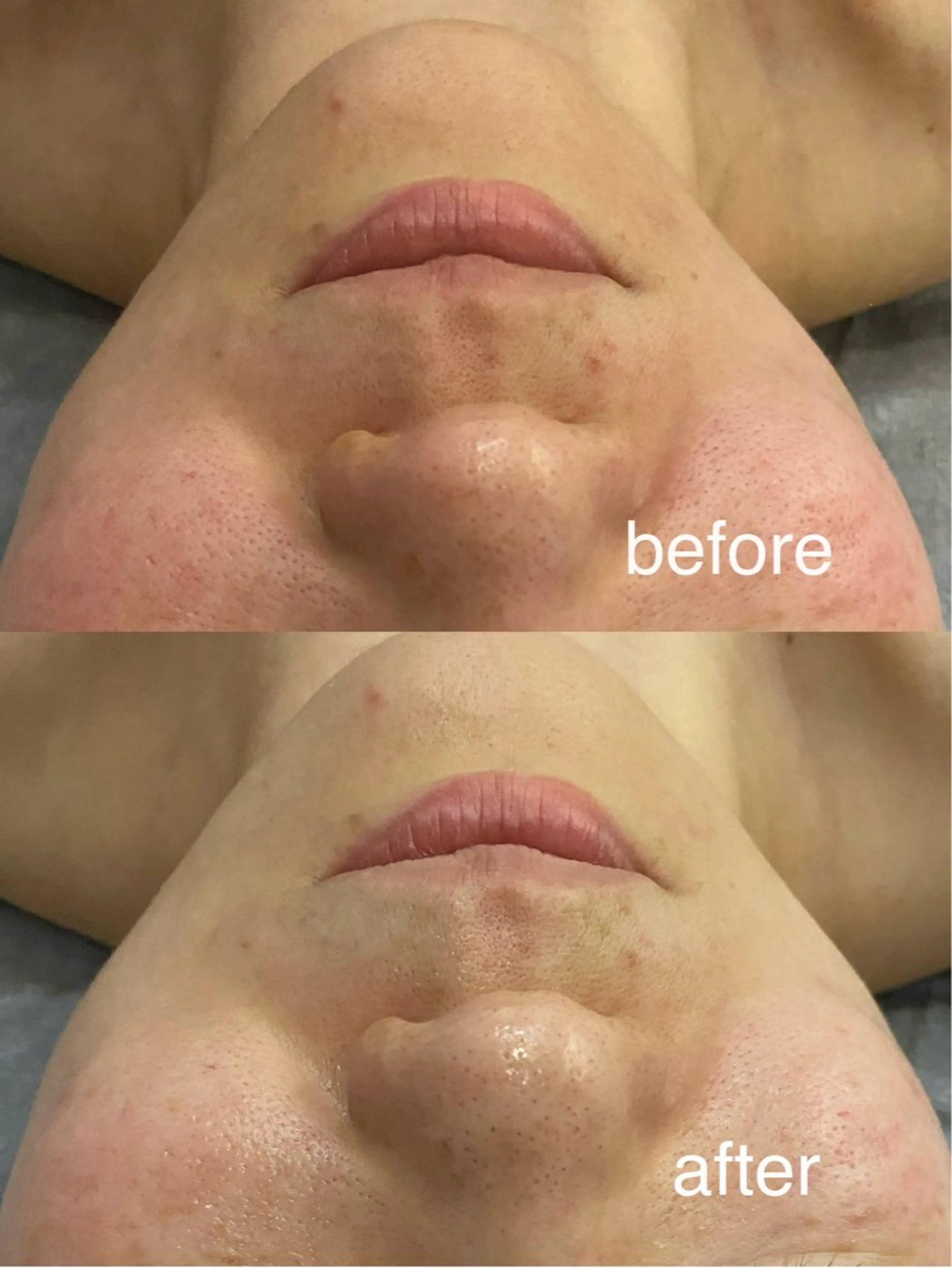 アロマオイルリンパ マッサージ💆‍♀️のエステ・リラクイメージ