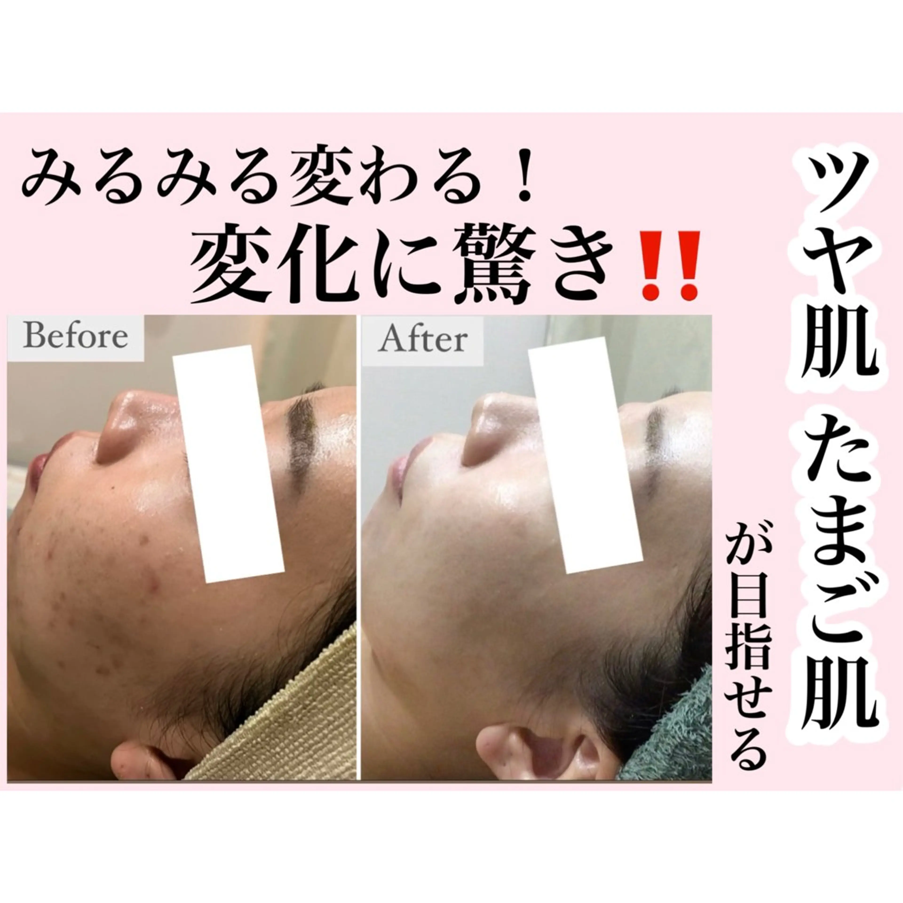 ハーブピーリング専門 muro.のエステ・リラクイメージ