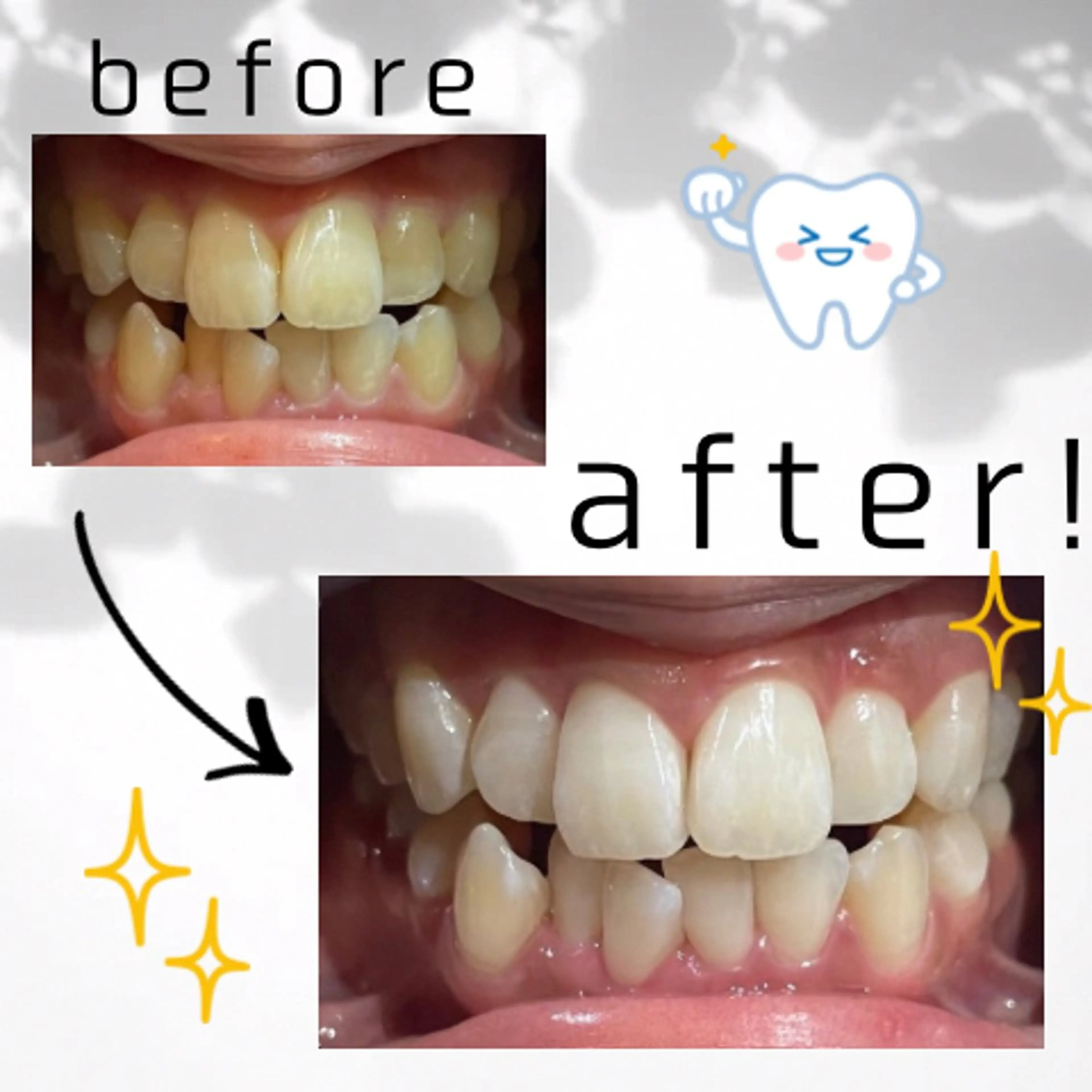 サクッとホワイト都立大学店所属・セルフホワイトニング 都立大学🦷✴︎のその他イメージ